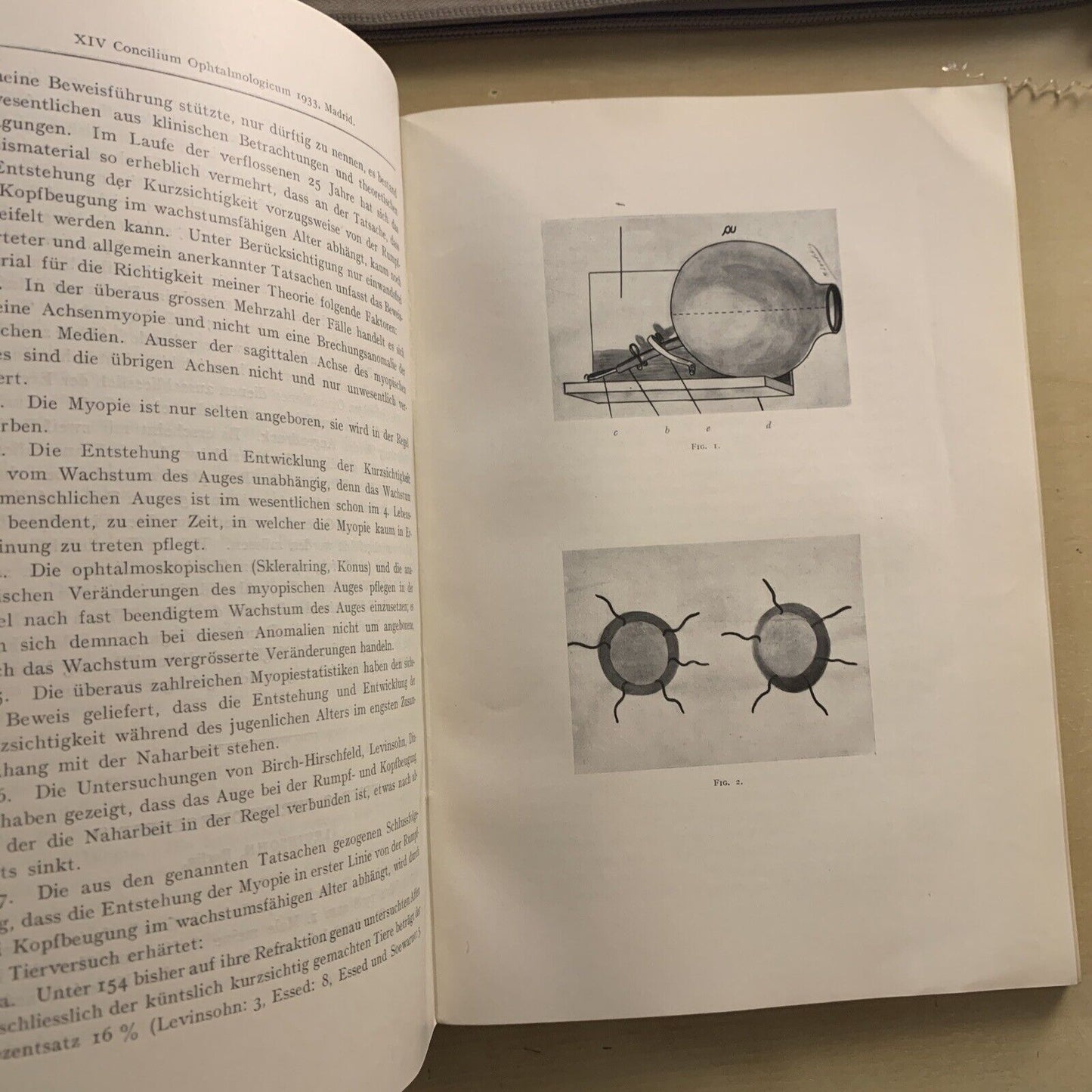 TUBERCULOSIS DEL IRIS Y DEL CUERPO CILIAR - concilium ophtalmologicum 1933 #