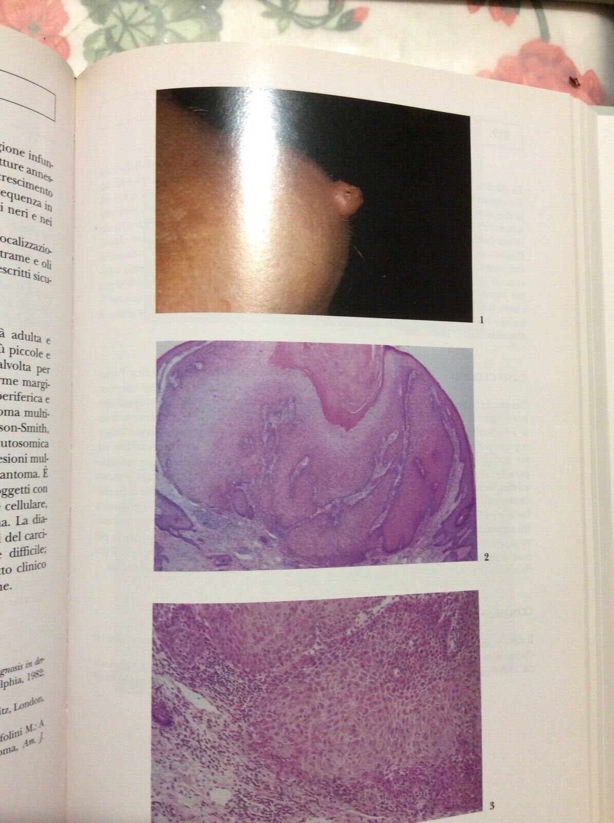 DERMATOLOGIA CLINICA,CAINELLI MARCHESI, 300 casi inusuali , McGraw-Hill, 2 vol