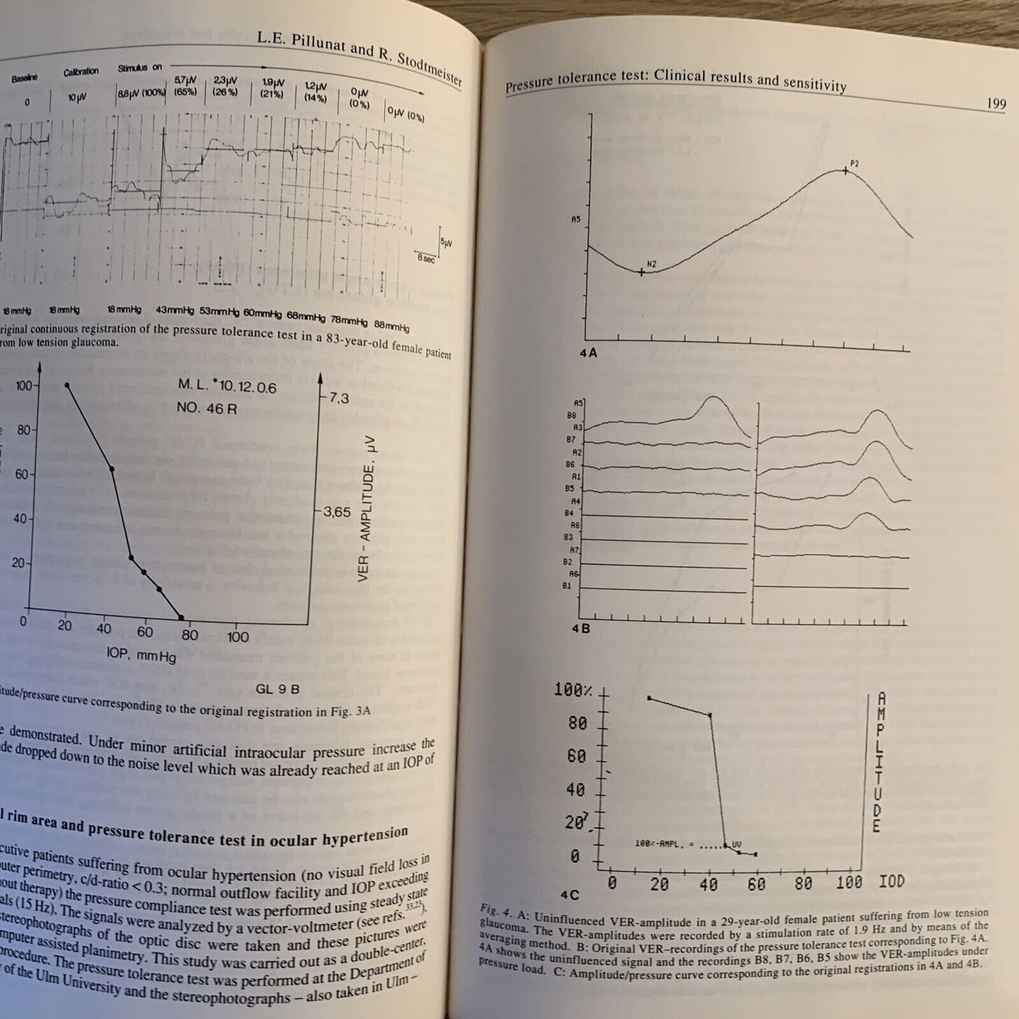 OCULAR BLOOD FLOW IN GLAUCOMA means methods and measurements. Lambrou L. Greve