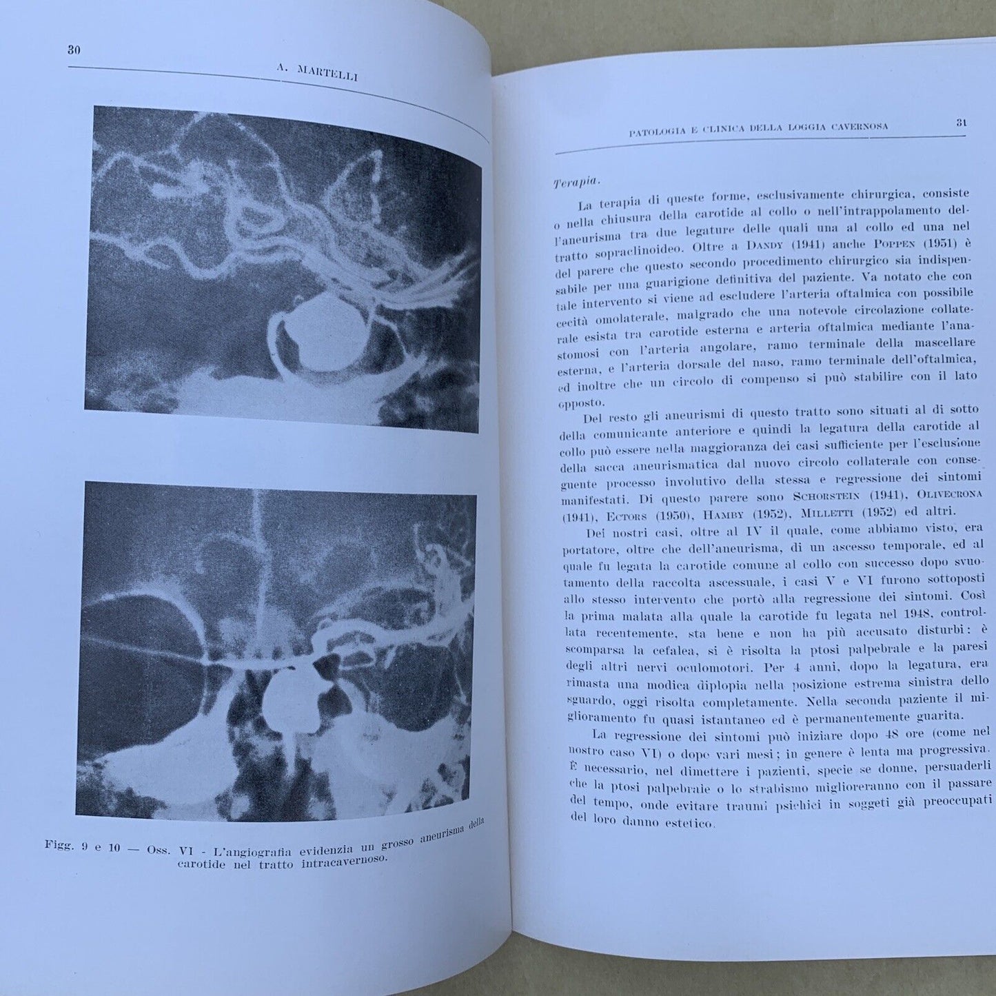 Patologia e clinica della loggia cavernosa, Aldo Martelli Oto neuro oftalmologia