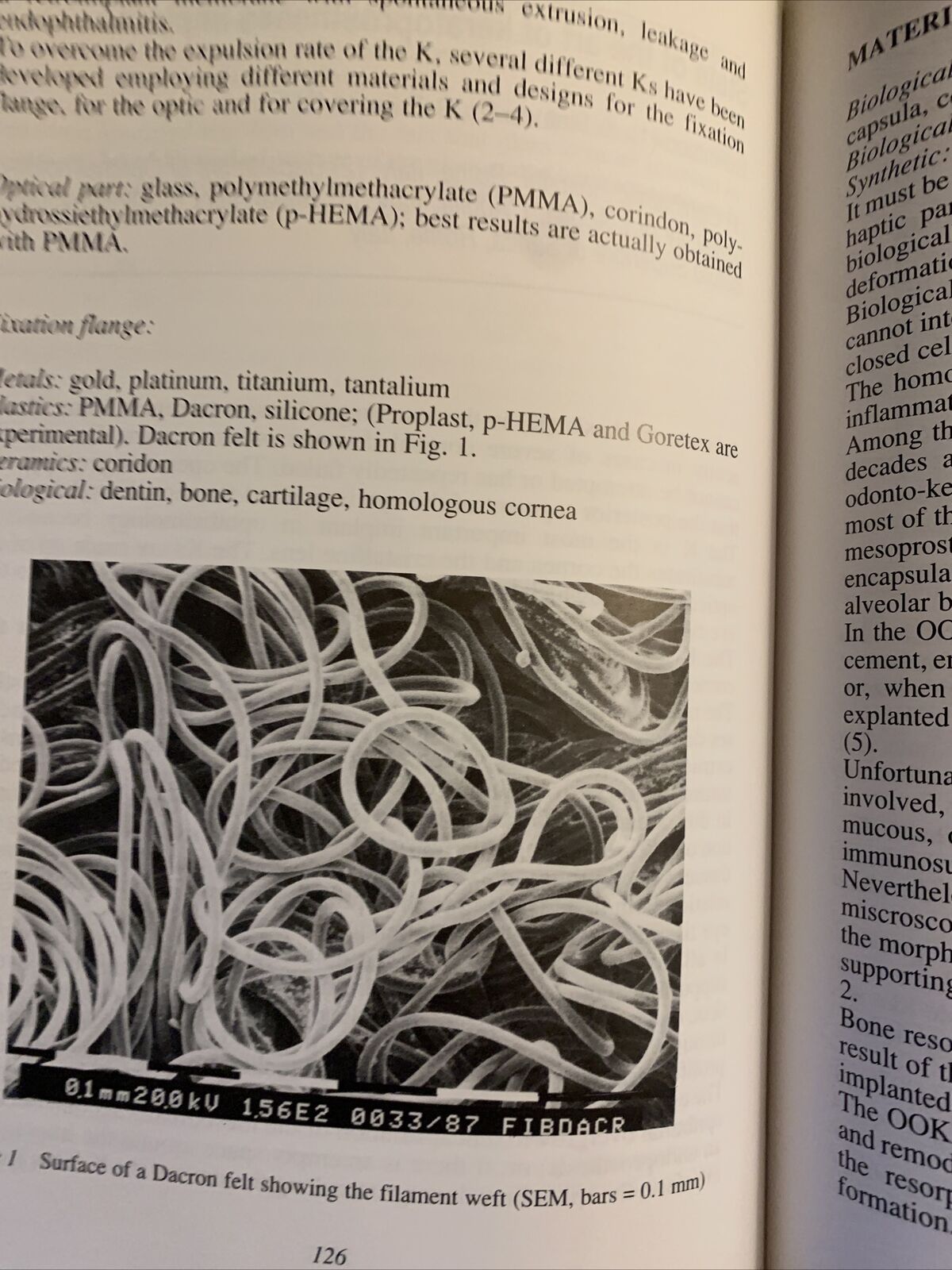 BIOMATERIALS IN OPHTALMOLOGY an interdisciplinary approach. Caramazza, Versura #