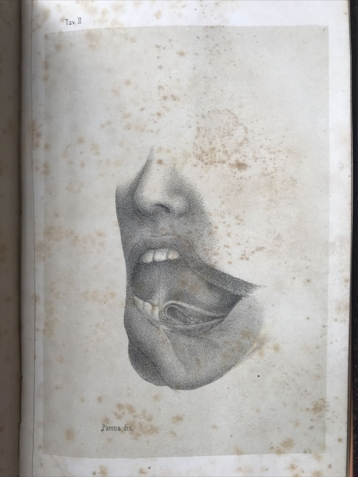 LA SALIVA UMANA, Eusebio Ohel 1864. **MEDICINA - MOLTO RARO INTROVABILE**
