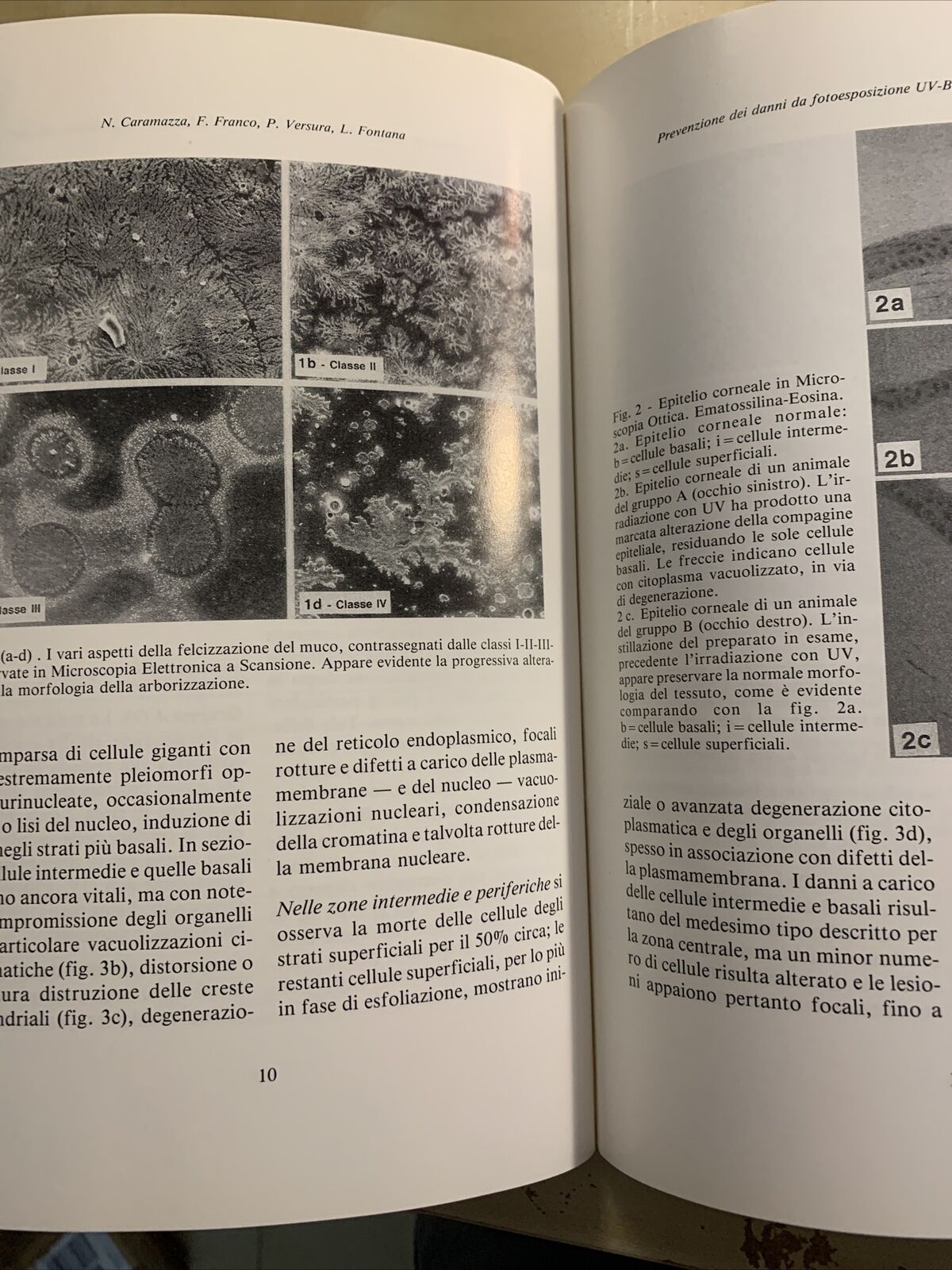 Bollettino di oculistica - anno 72 n. 1 anno 1993. Cappelli editore #