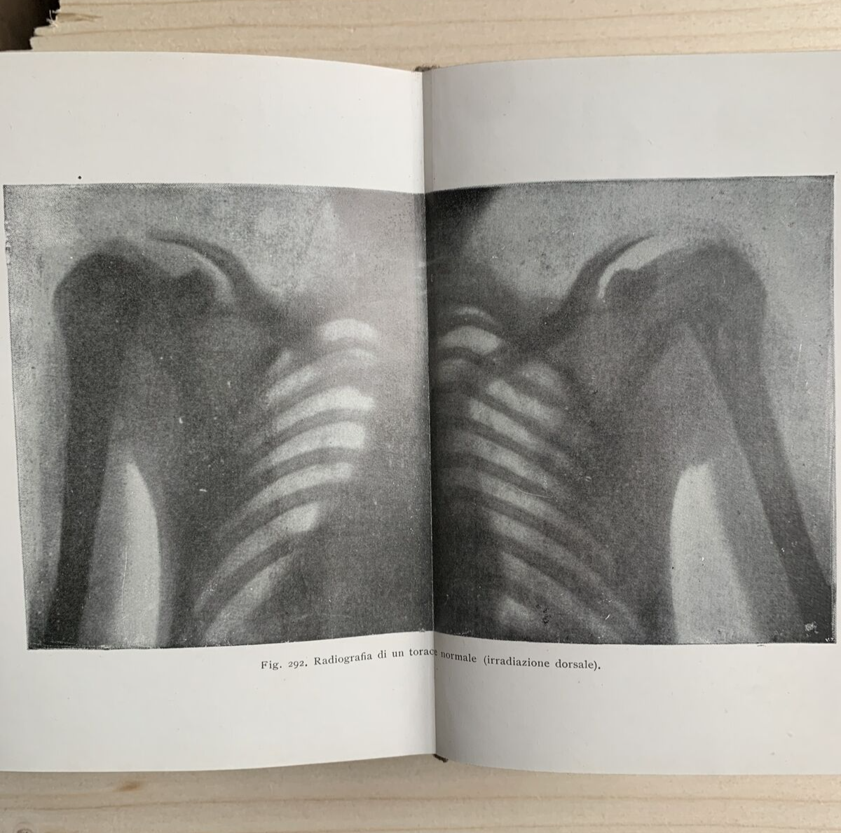 FISICA MEDICA - C. P. GOGGIA - Fisiologia Clinica Terapia Hoepli editore, 1912 #