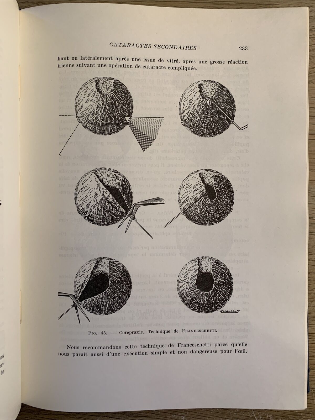 Traitement Chirurgical des Affections Oculaires. Tome 1 - L. Guillaum