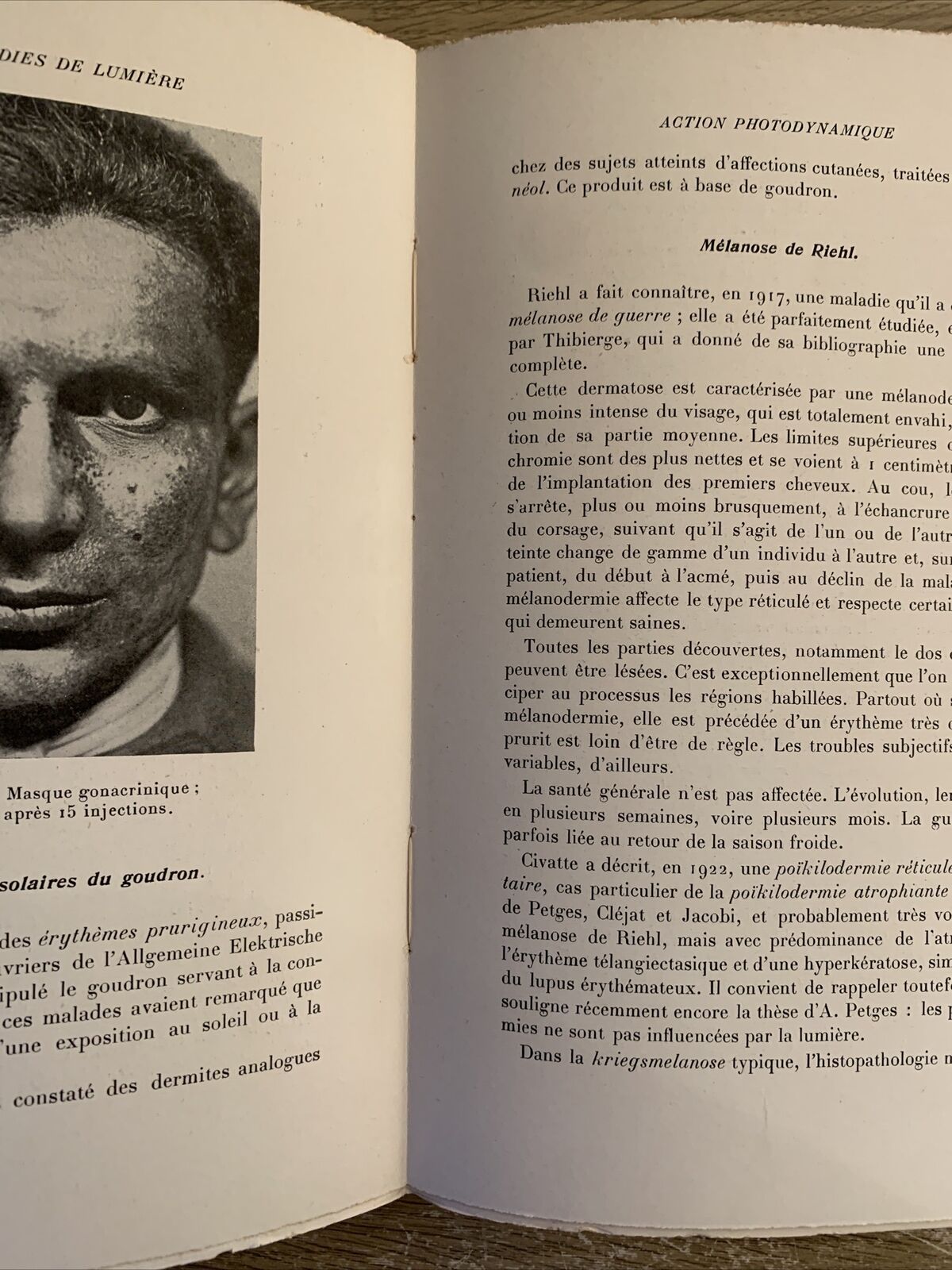 LES MALADIES DE LUMIÈRE et leur traitement. Hubert Jausion, Francois Pagès 1933