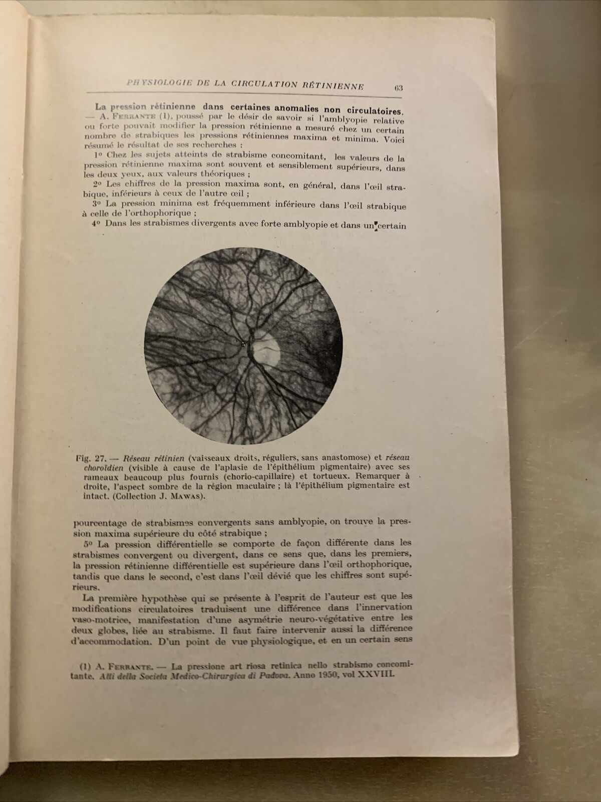 AFFECTIONS VASCULAIRES DE LA RÉTINE - BAILLART. G. DOIN CIE #