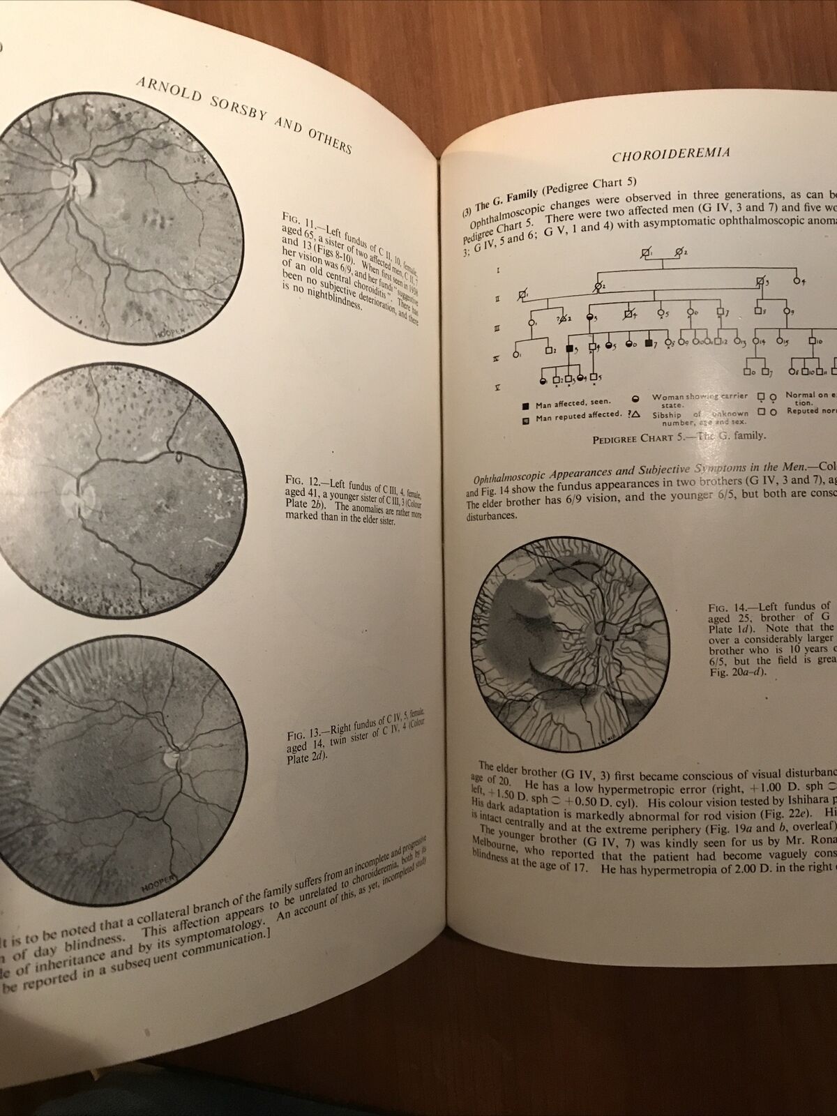 BRITISH JOURNAL OF OPHTHALMOLOGY oftalmologia, vol. XXXVI 1952 - S. Duke-Elder
