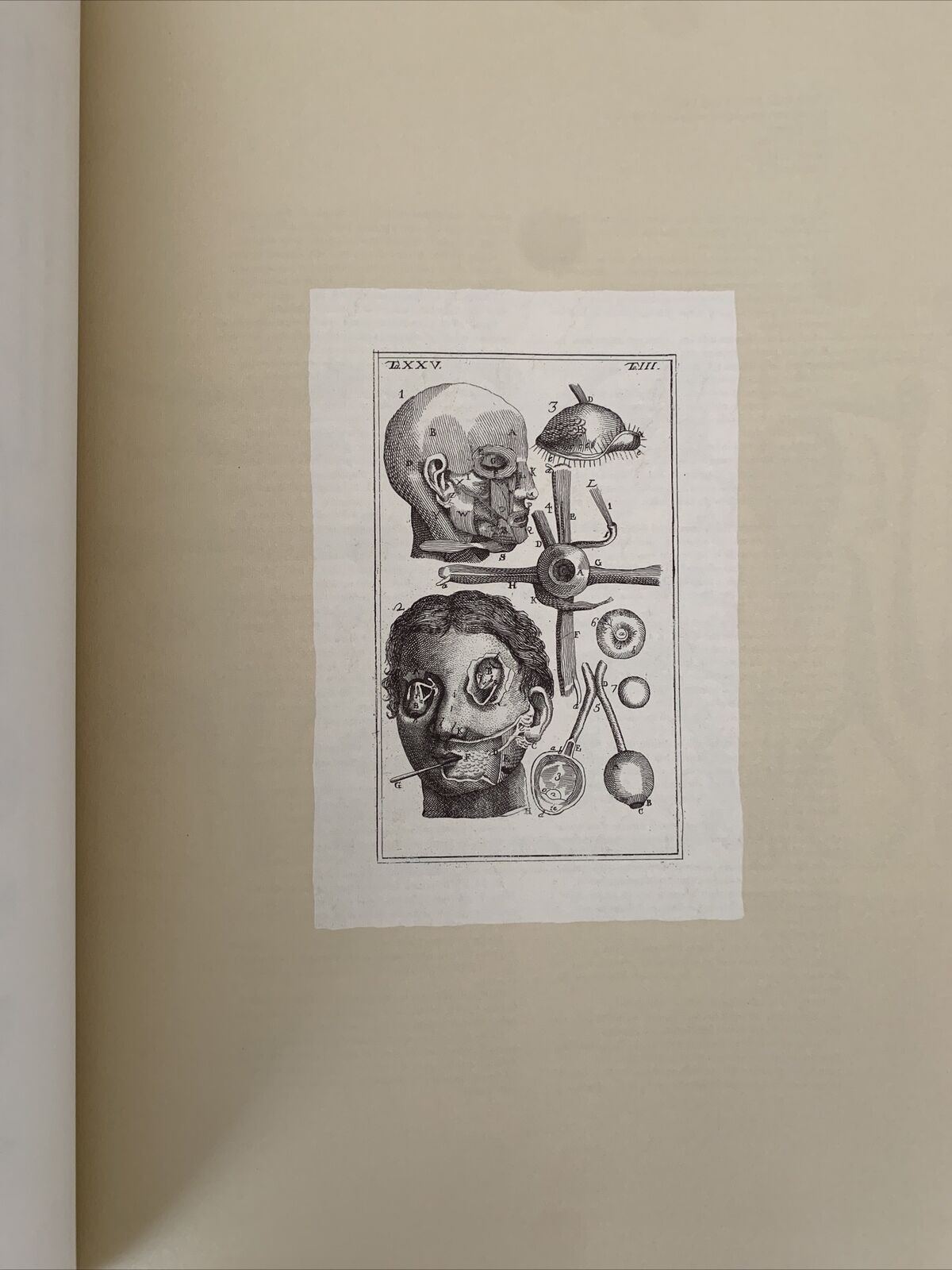 Icones ophthalmologicae - Francesco Loperfido - Casa editrice Mattioli 1992 #