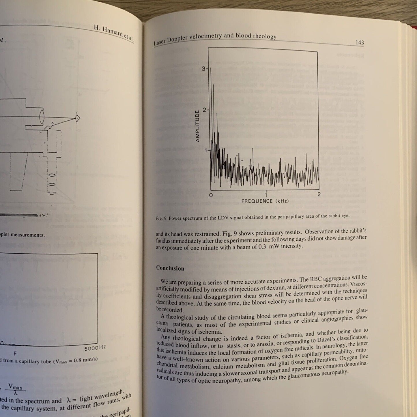 OCULAR BLOOD FLOW IN GLAUCOMA means methods and measurements. Lambrou L. Greve