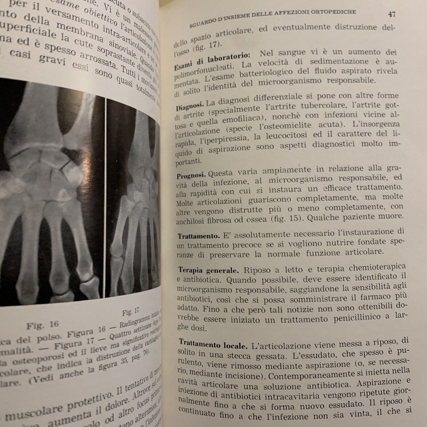 COMPENDIO DI ORTOPEDIA - J. C. ADAMS, RENZO CORTINA 1957