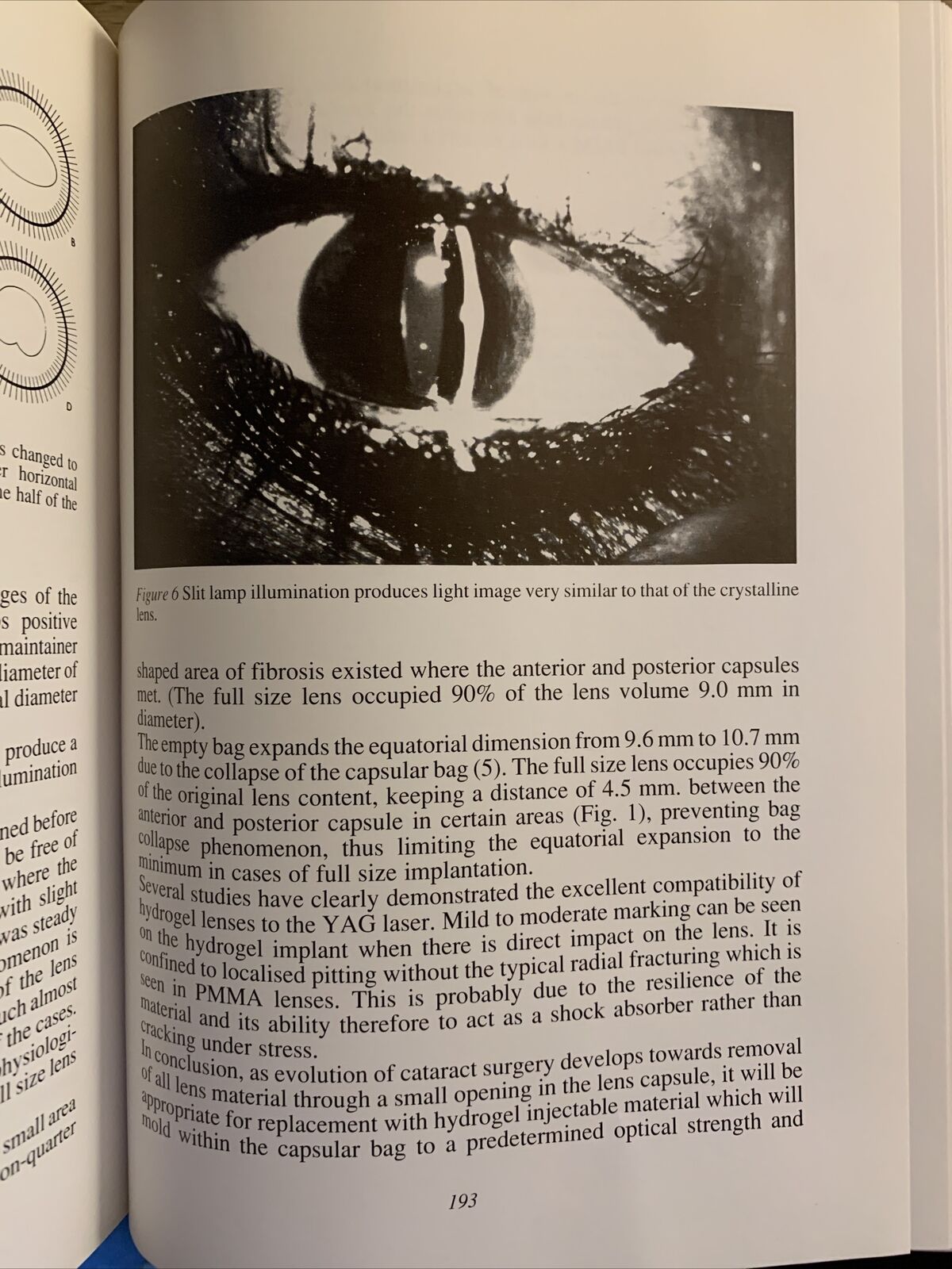BIOMATERIALS IN OPHTALMOLOGY an interdisciplinary approach. Caramazza, Versura #