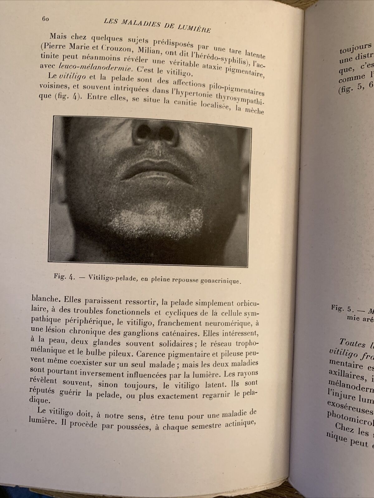 LES MALADIES DE LUMIÈRE et leur traitement. Hubert Jausion, Francois Pagès 1933