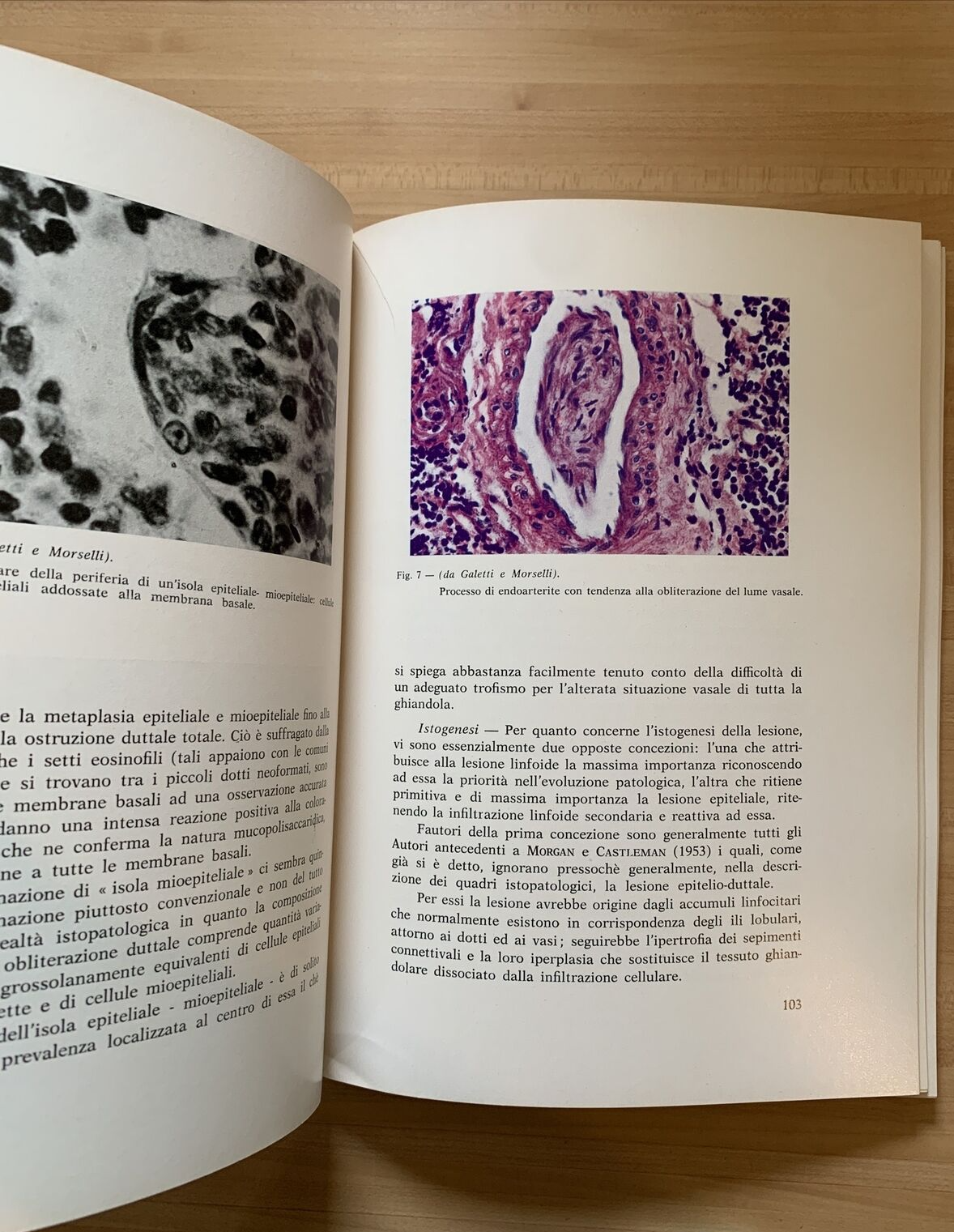 SINDROMI E MALATTIE OCULO SALIVARI - Remaggi, Lecco, Galetti. Toschi 1963