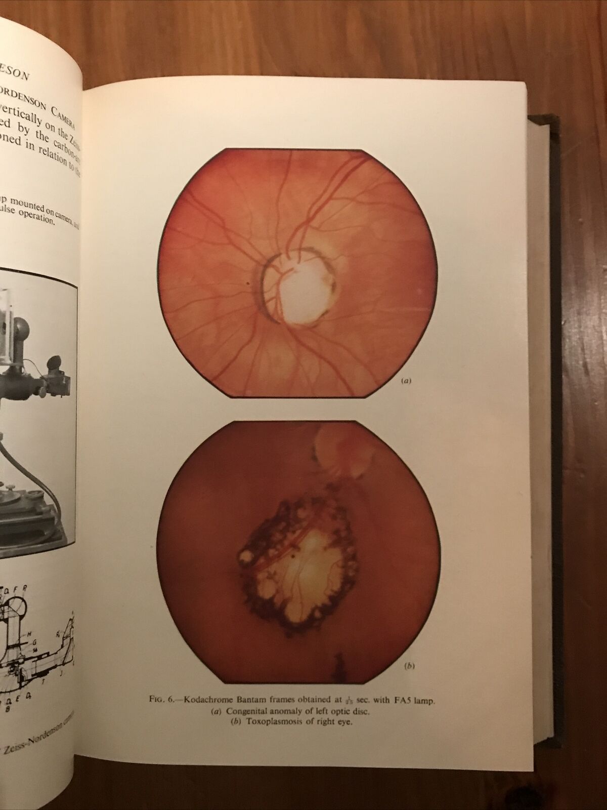 BRITISH JOURNAL OF OPHTHALMOLOGY oftalmologia, vol. XXXVII 1953 - S. Duke-Elder