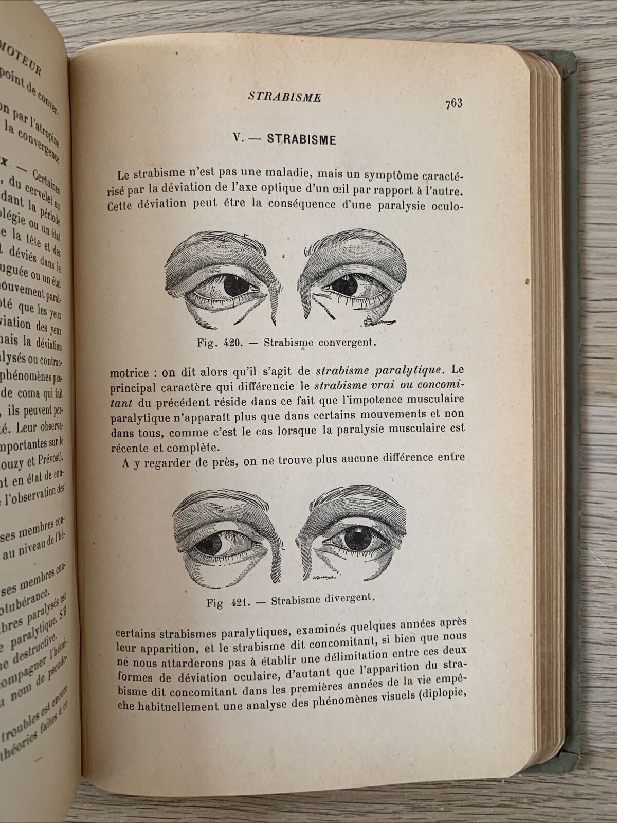 Précis d’ophtalmologie. V. Morax 1931. Masson & Cie Editeurs