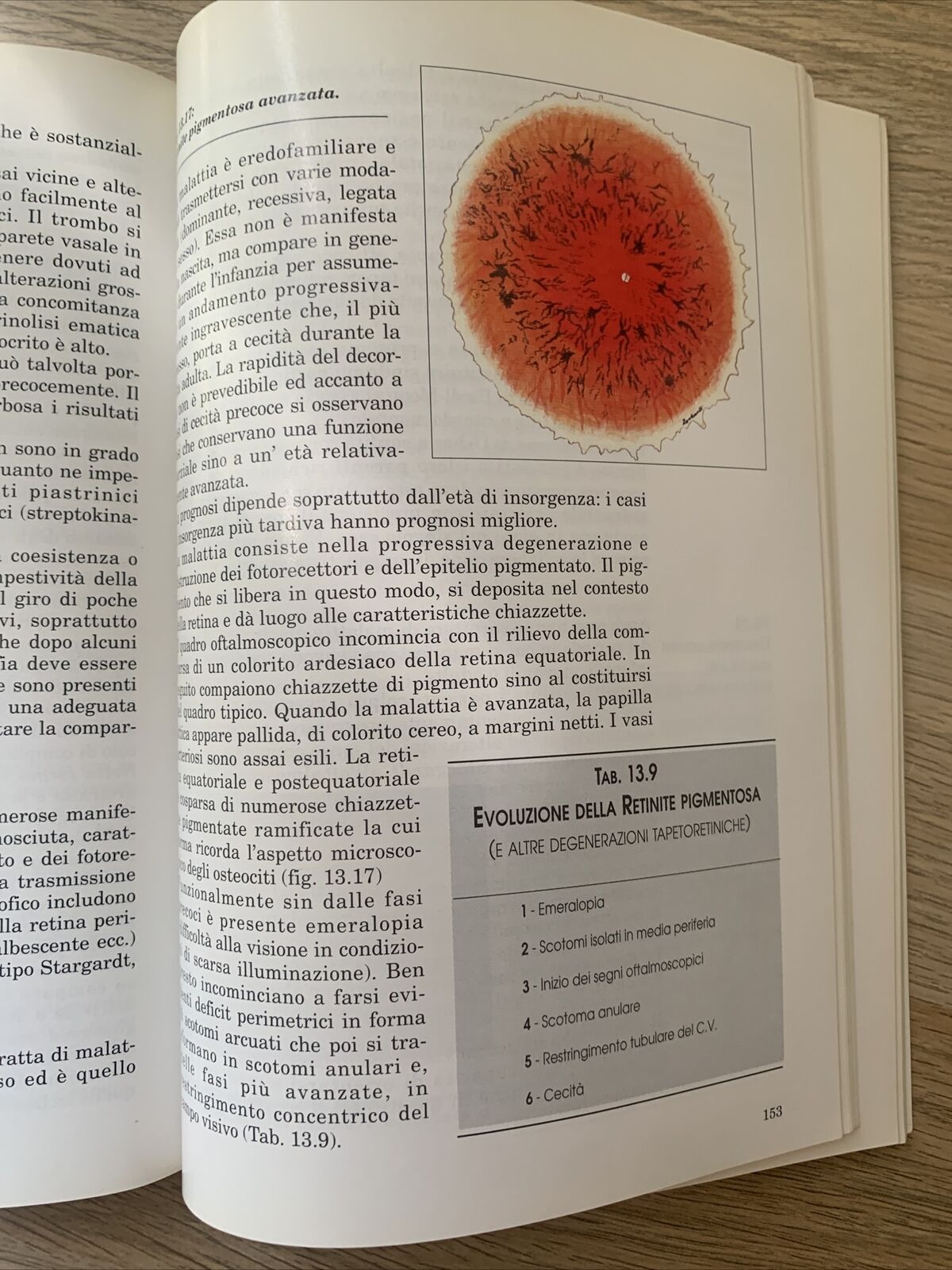 MANUALE PRATICO DI OFTALMOLOGIA - LUCIANO BONOMI, PROGEI EDITORI 1993 #