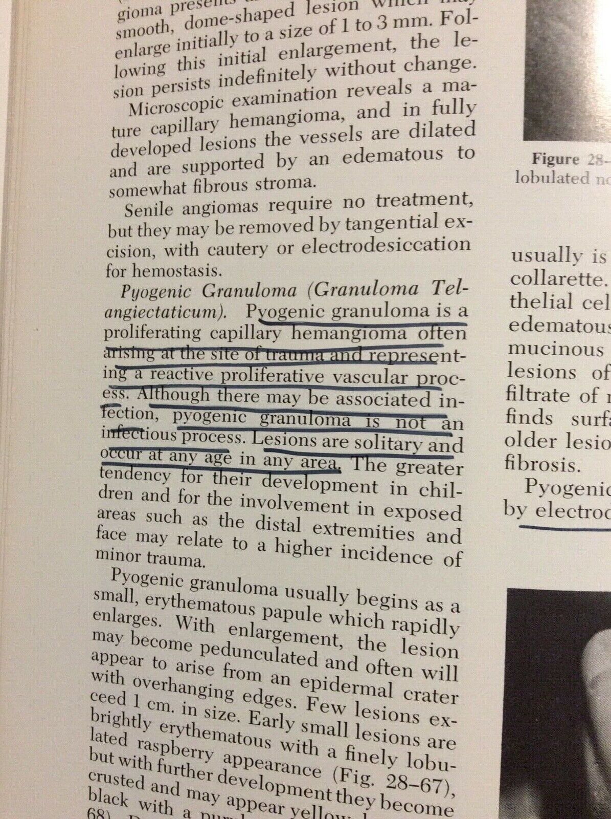 DERMATOLOGY MOSCHELLA PILLSBURY HURLEY SAUNDERS COMPANY TWO VOLUMES