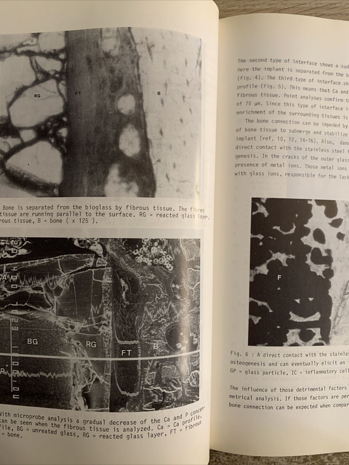 Biomaterials and clinical applications. Pizzoferrato , Marchetti, Ravaglioli.