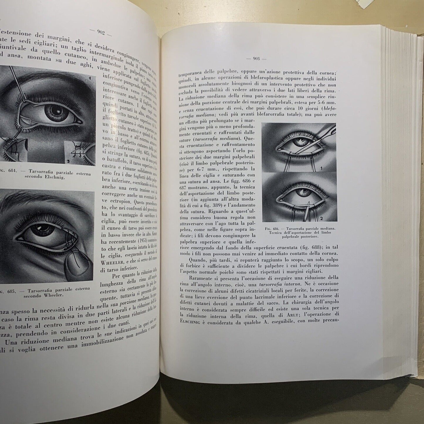 CHIRURGIA DELL'APPARATO OCULARE Volume secondo. E. LEONARDI. ARTE DELLA STAMPA #