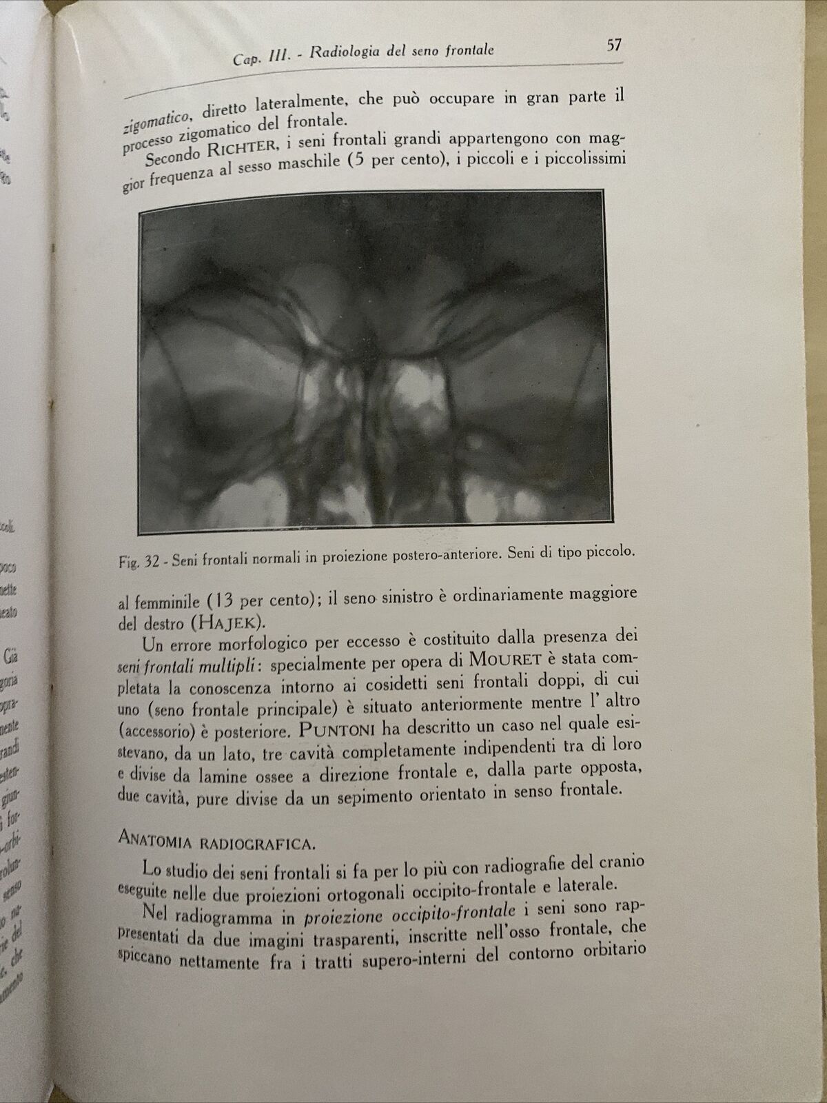 LA RADIOLOGIA IN OTORINO LARINGOLOGIA. G. LASCHI, VIGI. CAPPELLI 1931 #
