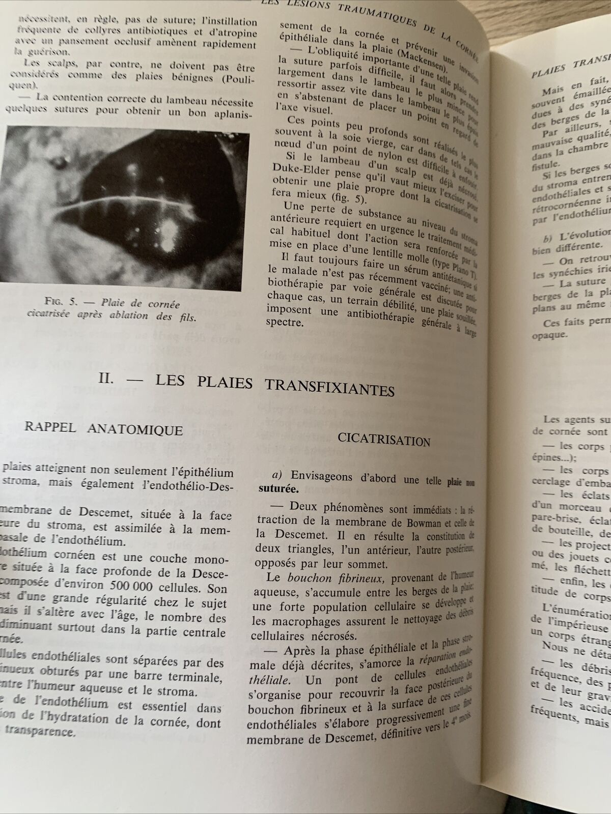 Plaies et contusions du segment anterieur de l'oeil. C. Boudet. Ophtalmologie #