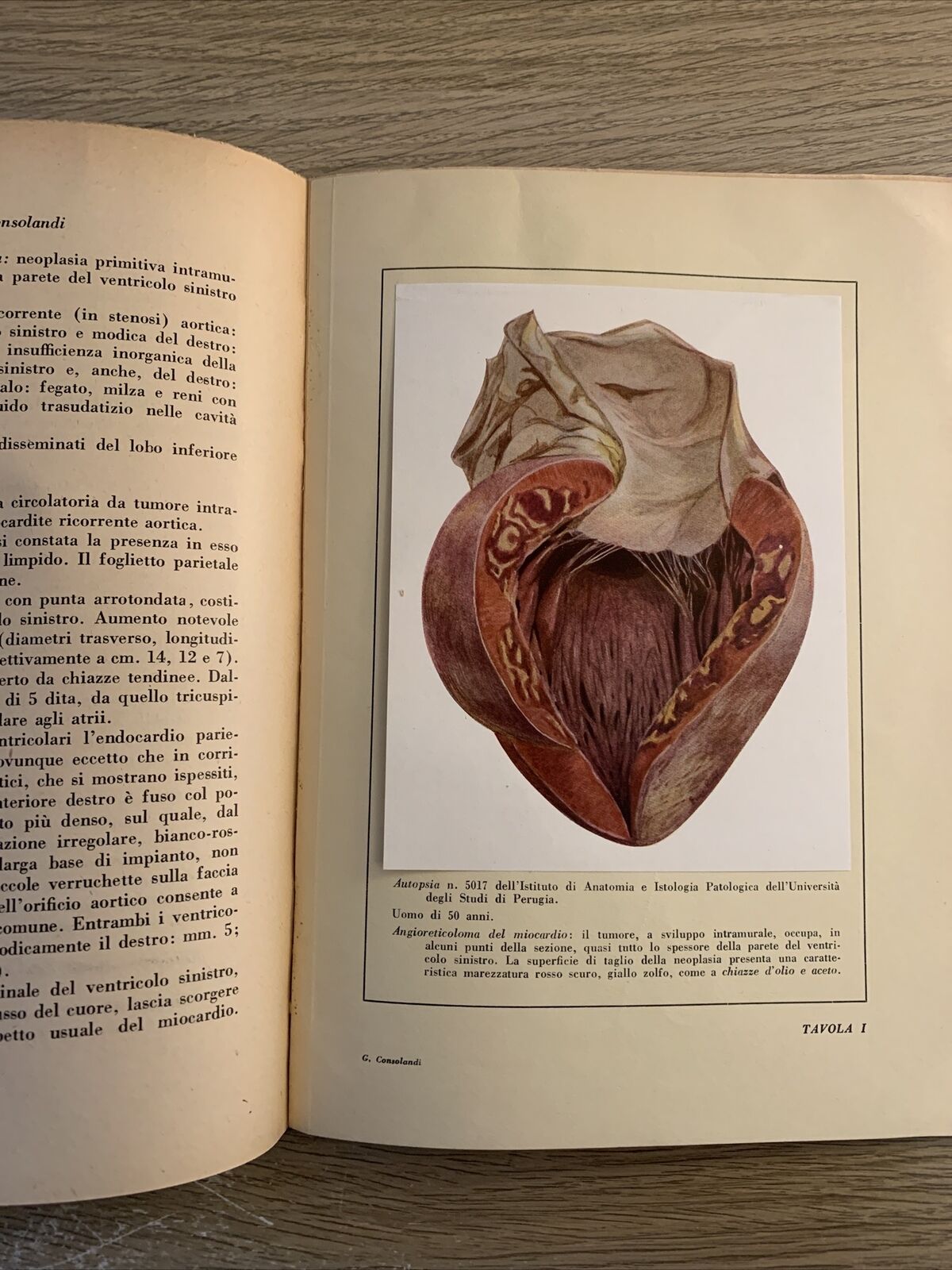 ISTITUTO DI ANATOMIA E ISTOLOGIA PATOLOGICA. LUCIO SEVERI. UNIVERSITÀ DI PERUGIA