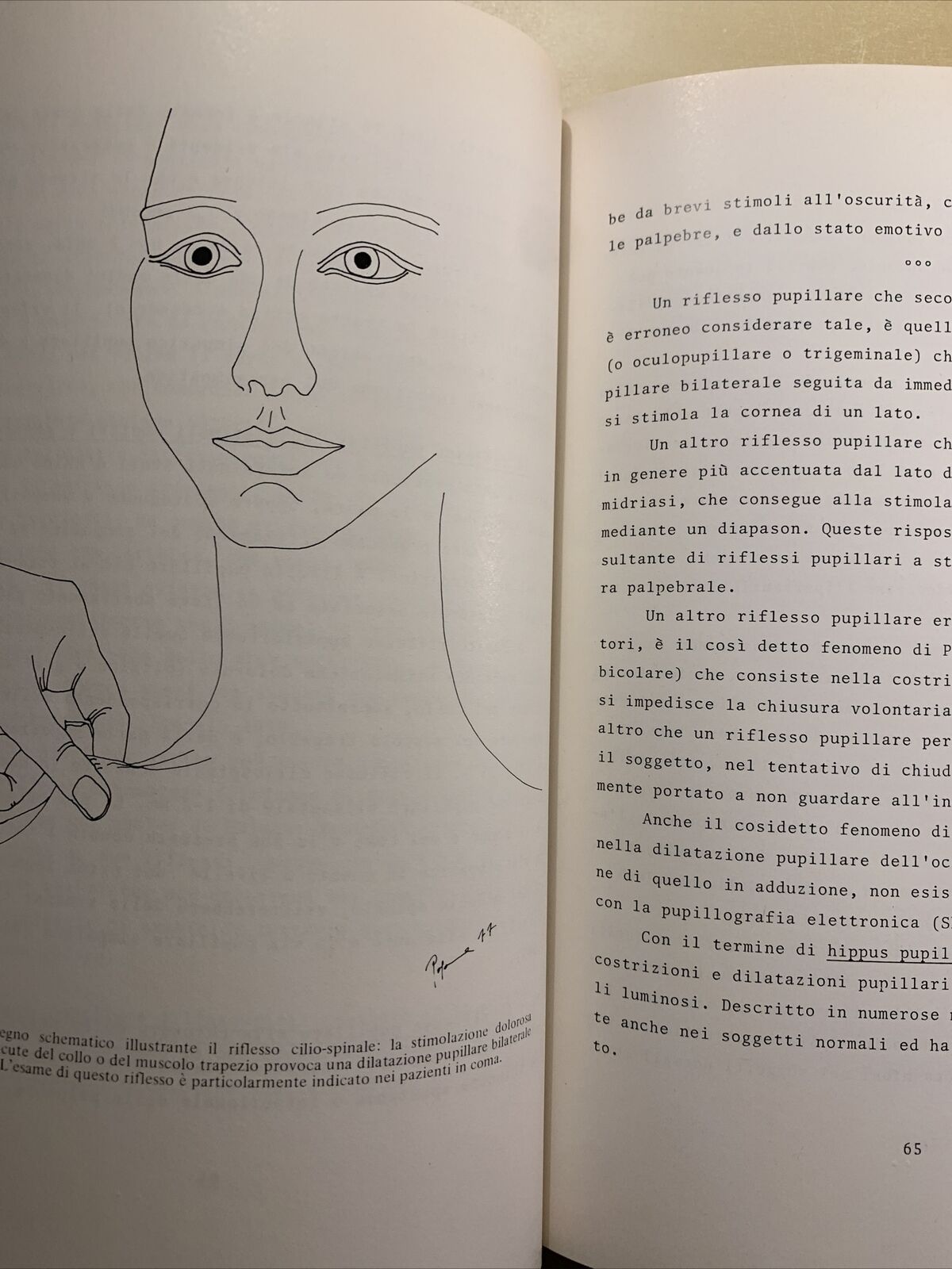 APPUNTI DI NEUROFTALMOLOGIA - PATOLOGIA DEL SISTEMA NERVOSO. F. CARTA 1977 #