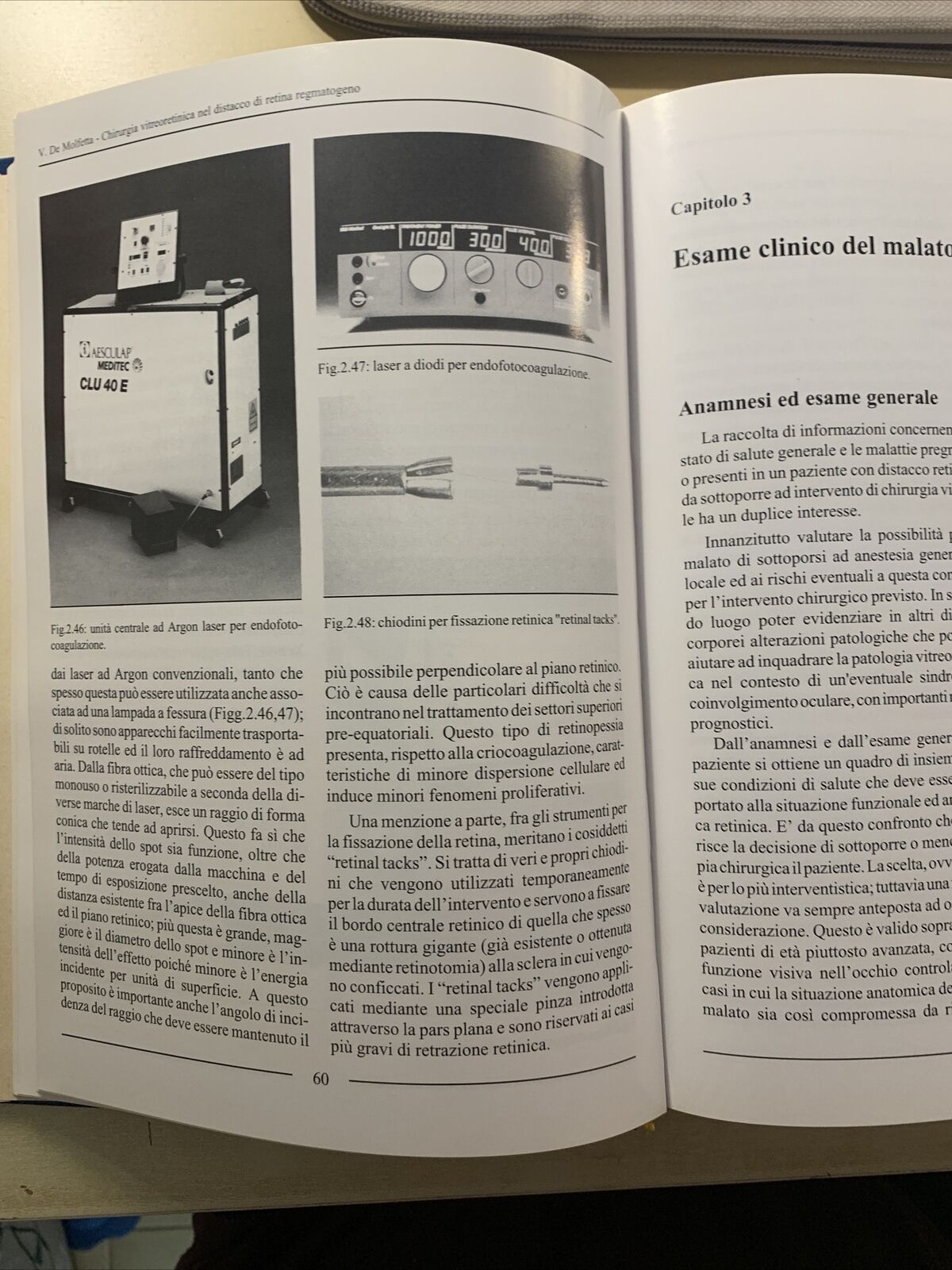 LA CHIRURGIA VITREORETINICA NEL DISTACCO DI RETINA REGMATOGENO. Molfetta Ghedini