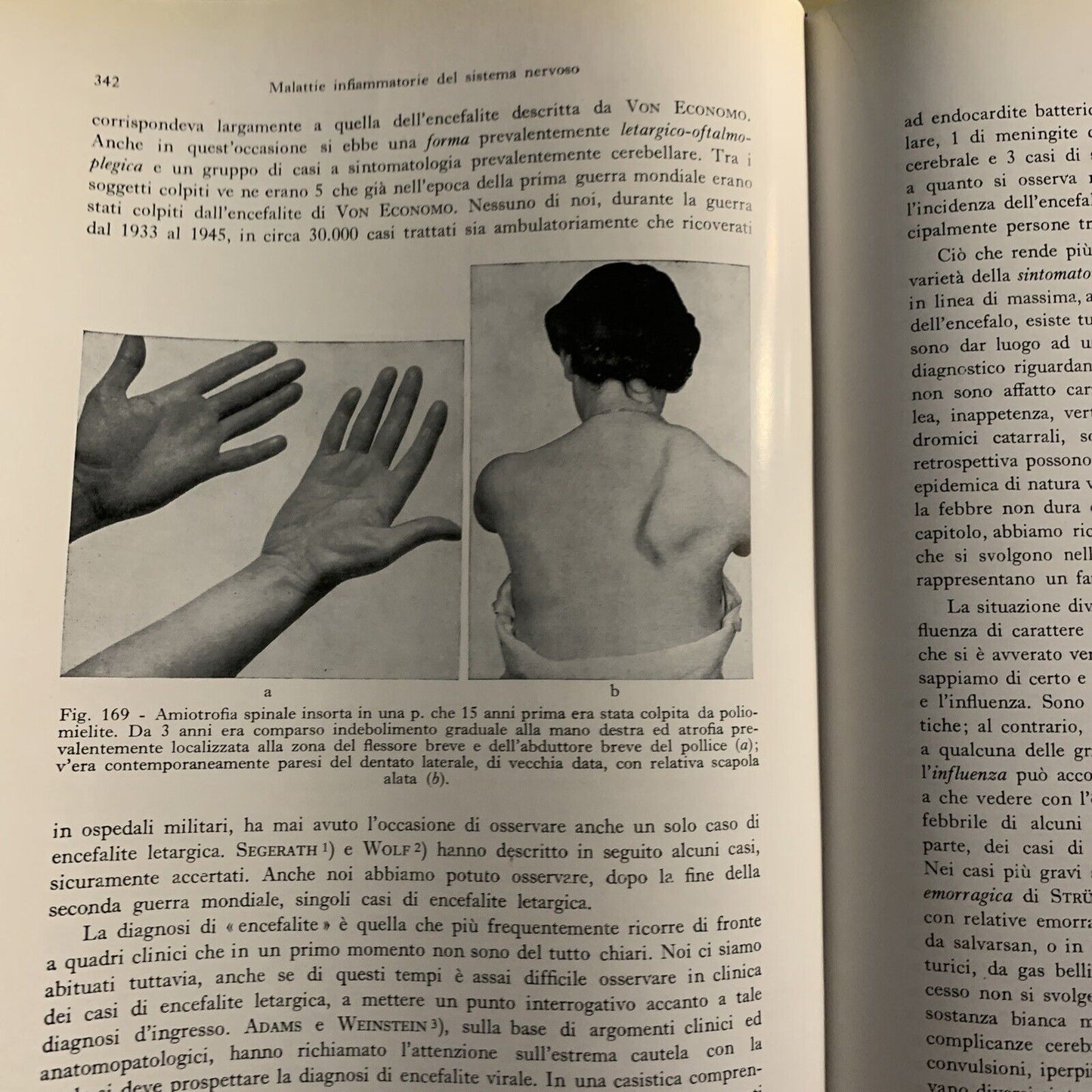 DIAGNOSI DIFFERENZIALE DELLE SINDROMI NEUROLOGICHE - BODECHTEL, ABRUZZINI 1961 #