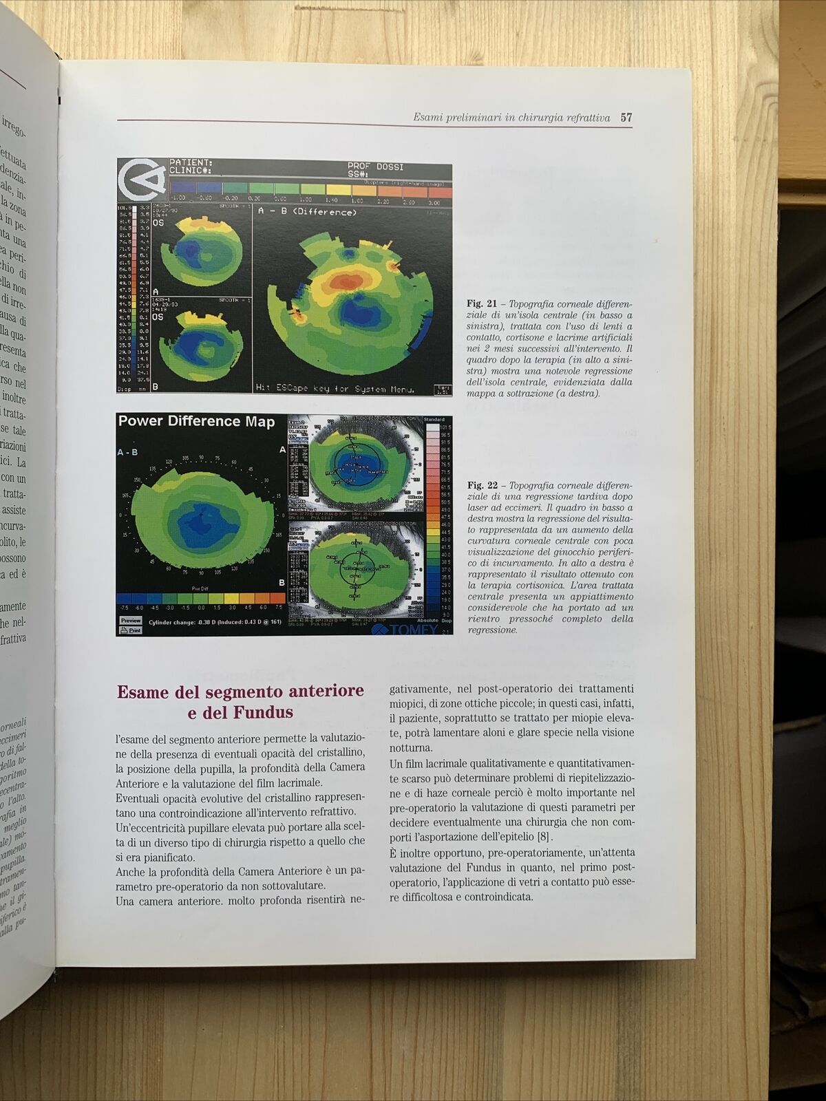 Chirurgia Refrattiva, Principi e Tecniche. Fabiano AICCER, OFTALMOLOGIA - 2000 #