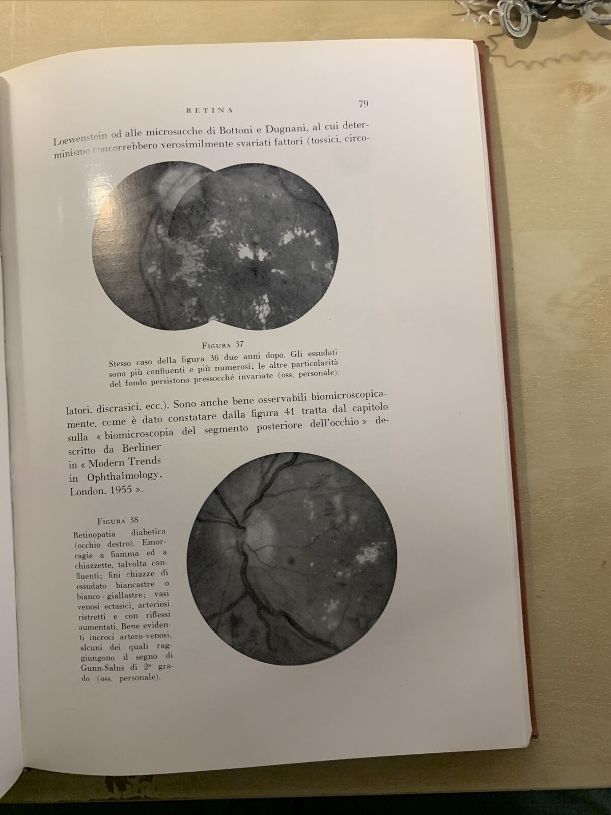 L'OCCHIO NEL DIABETE MELLITO - ALAGNA, SCULLICA, CASA EDITRICE G. D'ANNA 1956 #