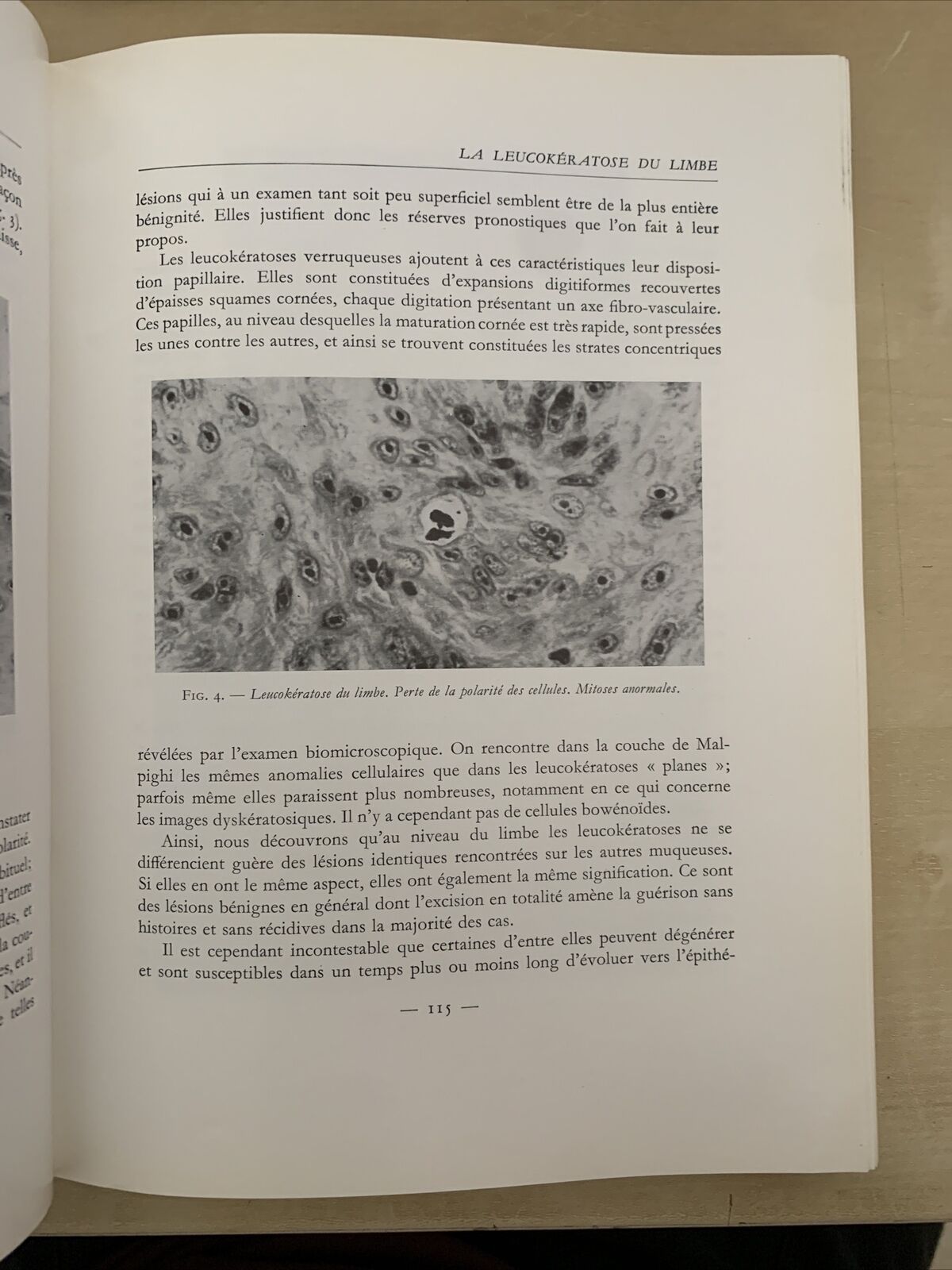TRAVAUX D'OPHTALMOLOGIE MODERNE - Mawas Jacques - Masson et Cie 1966 #