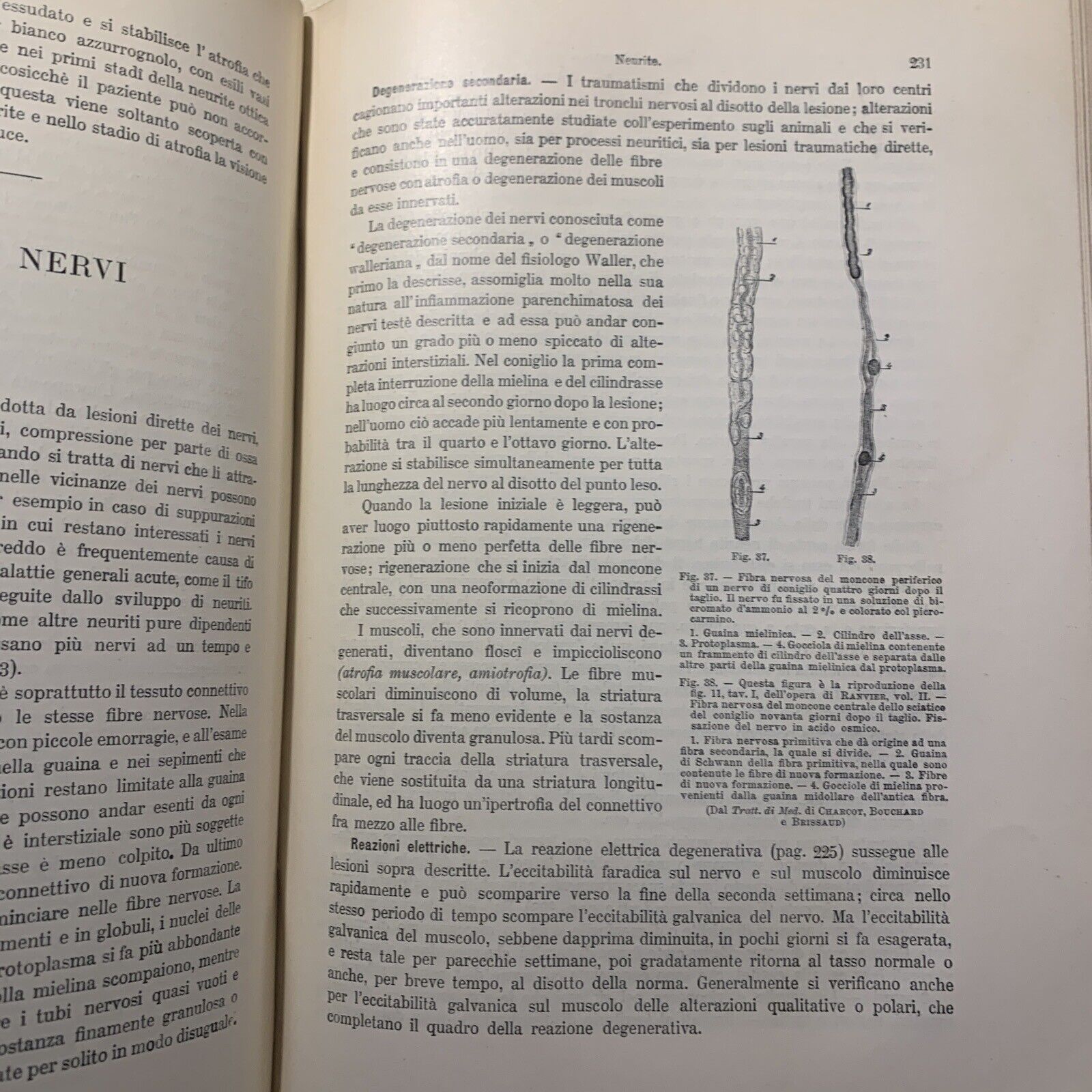 MANUALE PRATICO MEDICINA INTERNA - FEDERICO TAYLOR. UTET 1911. 2 VOLUMI #