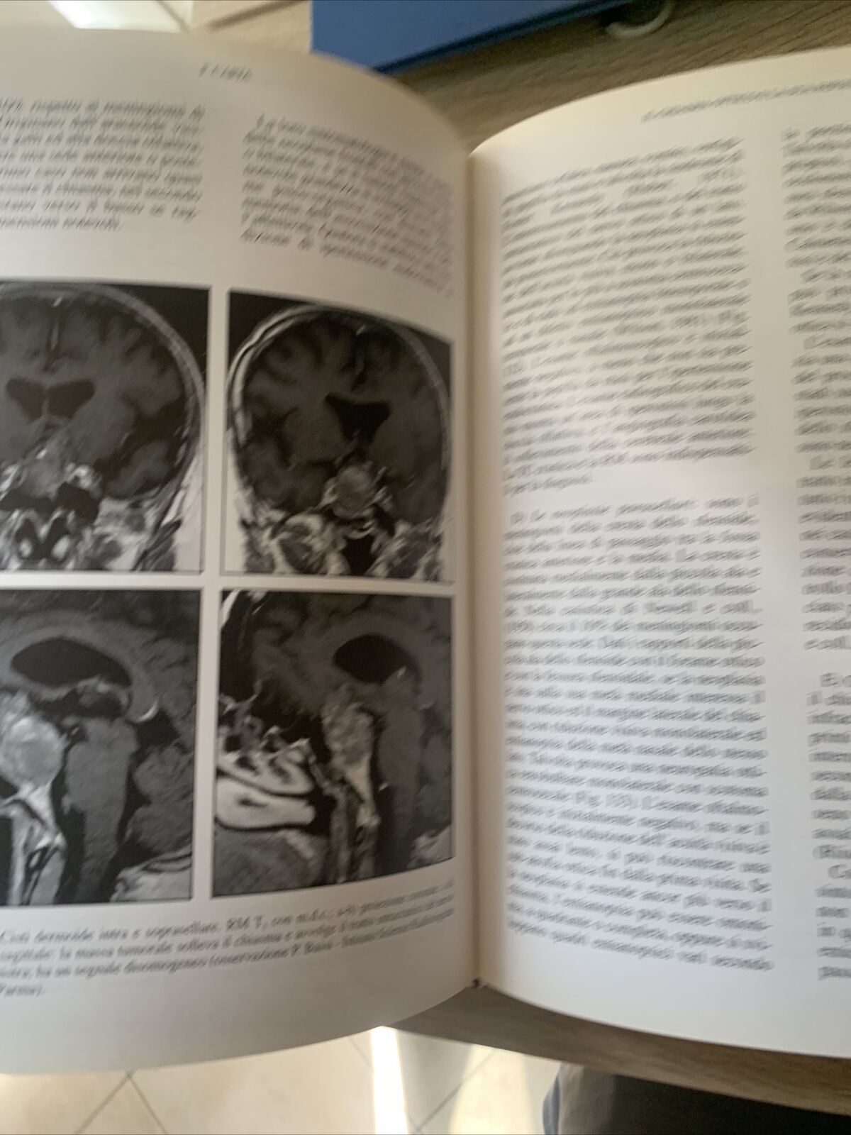NEUROFTALMOLOGIA - FRANCESCO CARTA, EDIZIONI SBM 1997 #