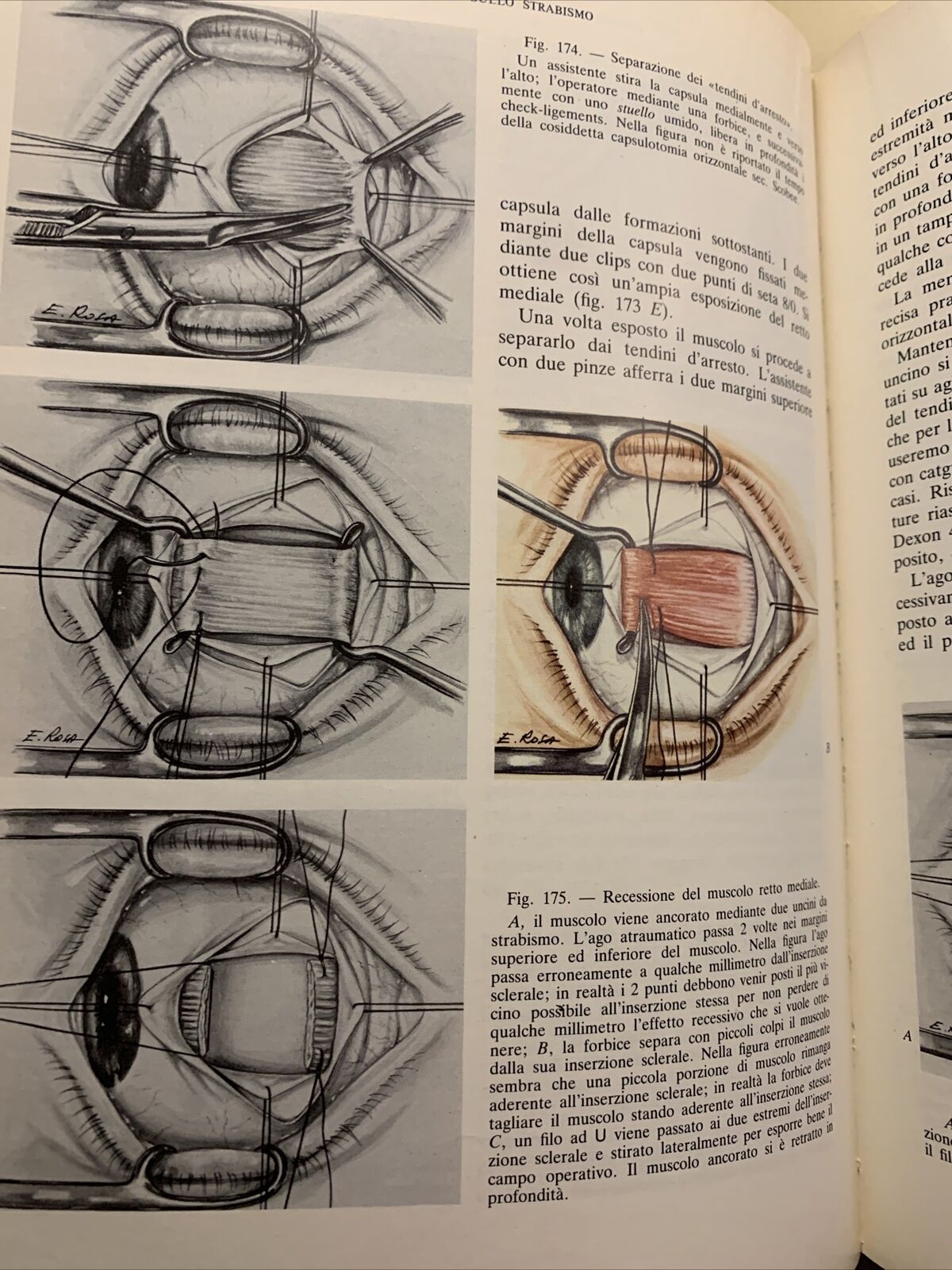 Tecnica Chirurgica. Chirurgia Oculistica UTET volume 10 - 1984 #