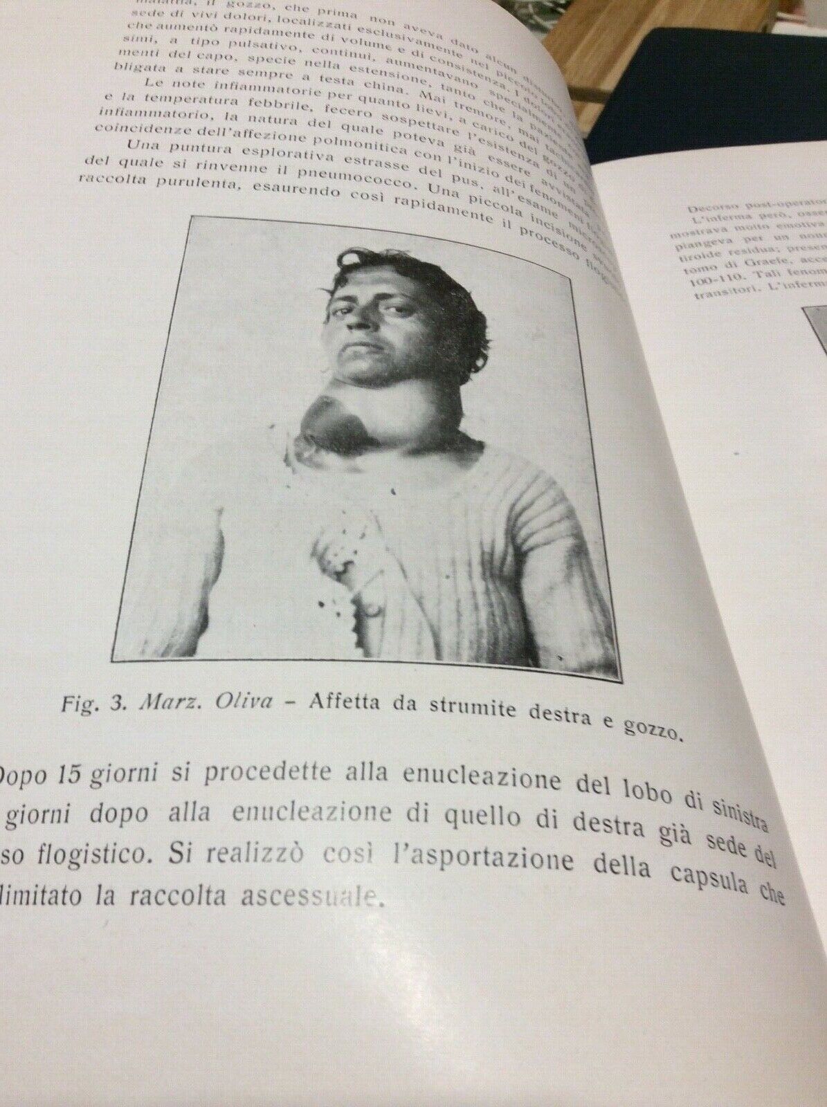 TRE ANNI DI CHIRURGIA A PARMA,TRINCAS DOCIMO,1932,ISTITUTO CLINICA CHIRURGICA 