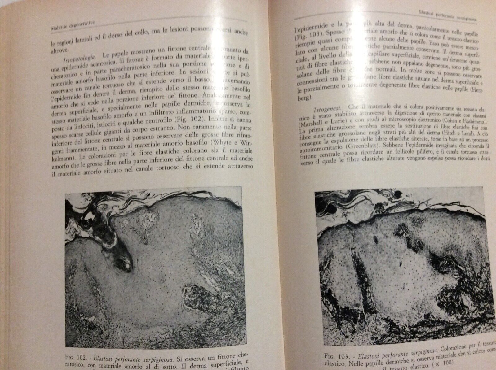 ISTOPATOLOGIA DELLA PELLE. WALTER F. LEVER 1970. Histopathology of the skin