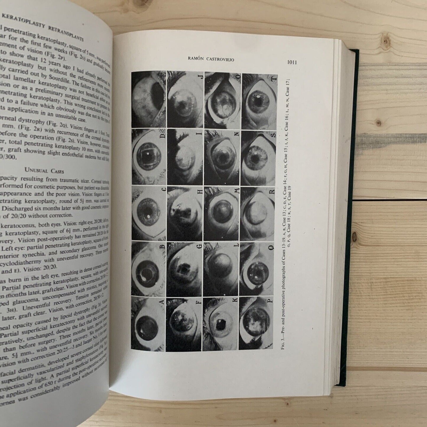 CONCILIUM OPHTHALMOLOGICUM XVI 1950 Britannia. Acta vol. II British Medical  #