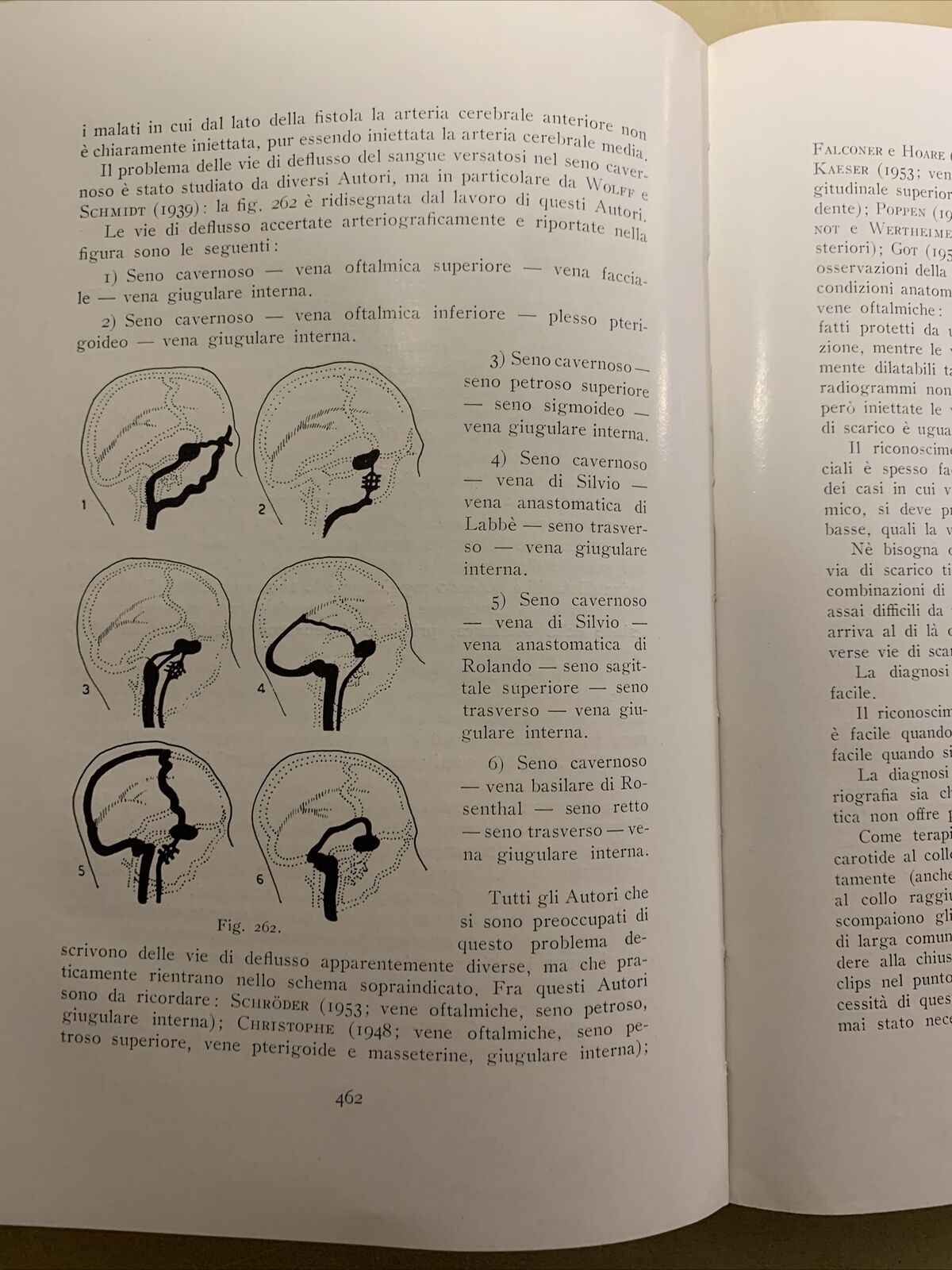 ANGIOGRAFIA CEREBRALE - MARIO MILLETTI, VOLUME PRIMO. LUIGI PARMA 1959