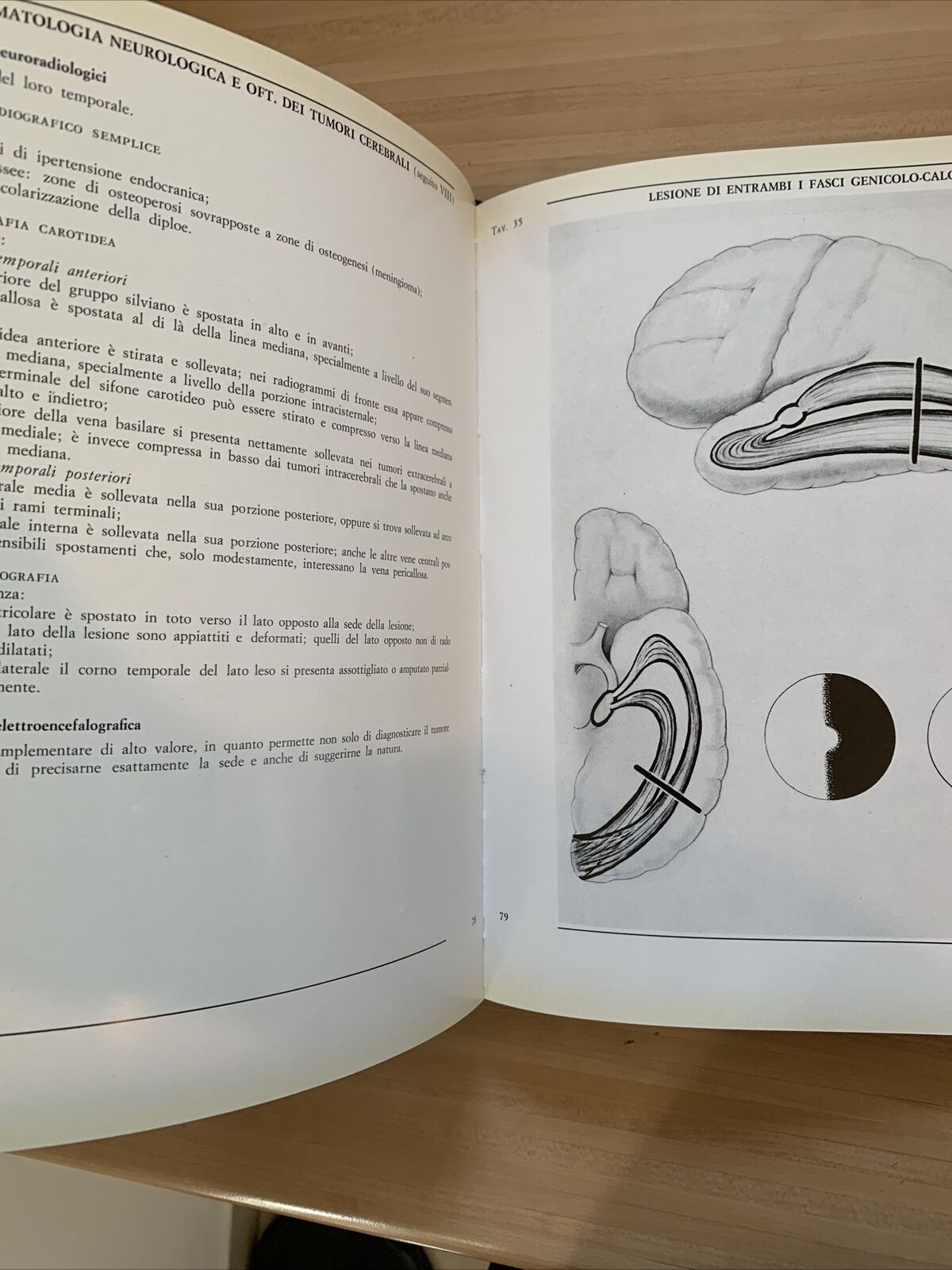 L'OCCHIO ICONOGRAFIA NEUROFTALMOLOGICA. parte seconda vol. 1 e2. Giorgio Vassura