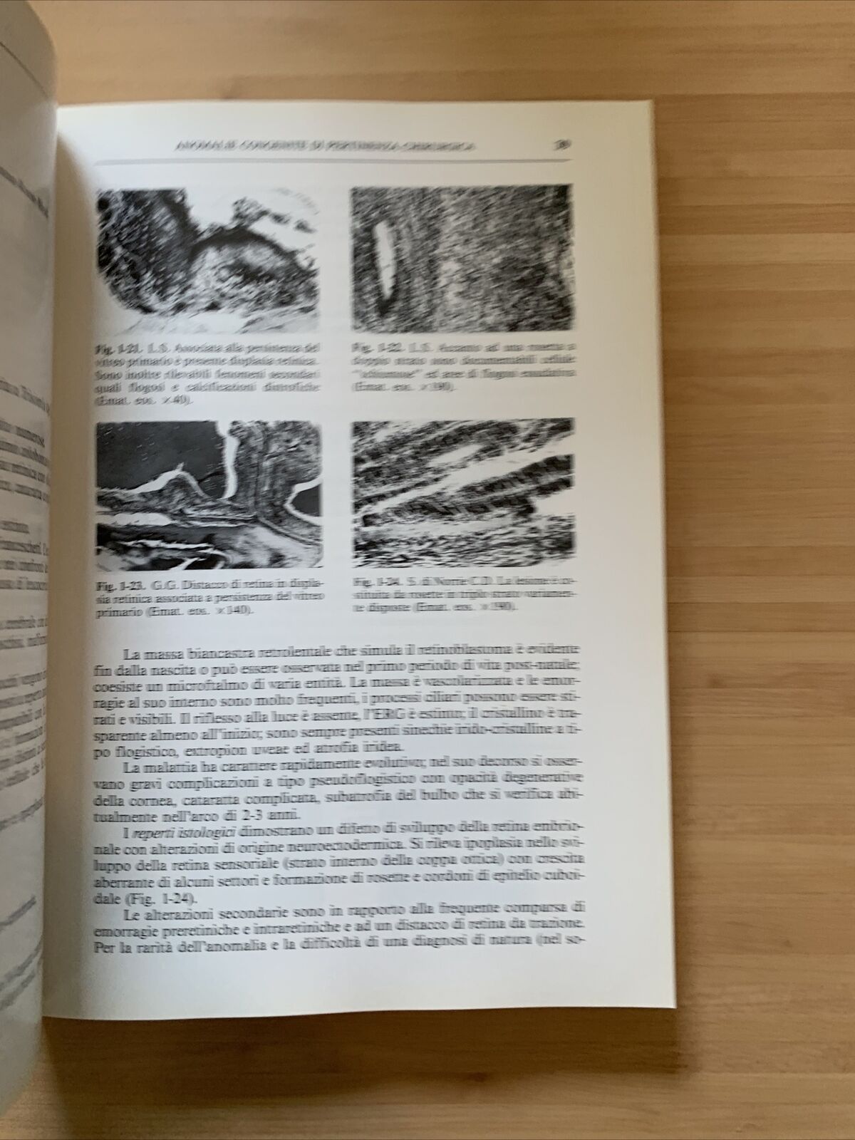 MALATTIE CONGENITE DELL'APPARATO OCULARE - Trattamento chirurgico. G. Scuderi