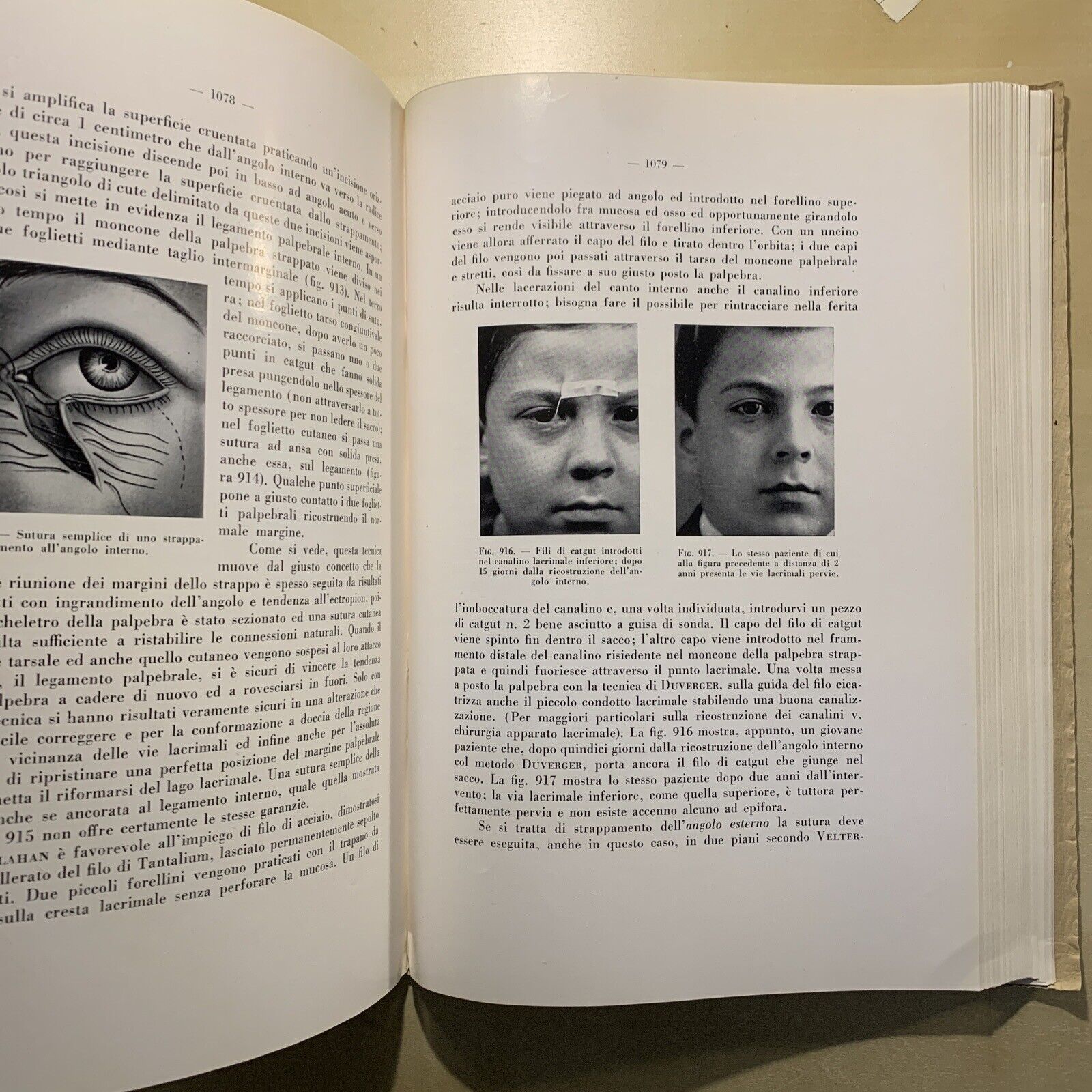 CHIRURGIA DELL'APPARATO OCULARE Volume secondo. E. LEONARDI. ARTE DELLA STAMPA #