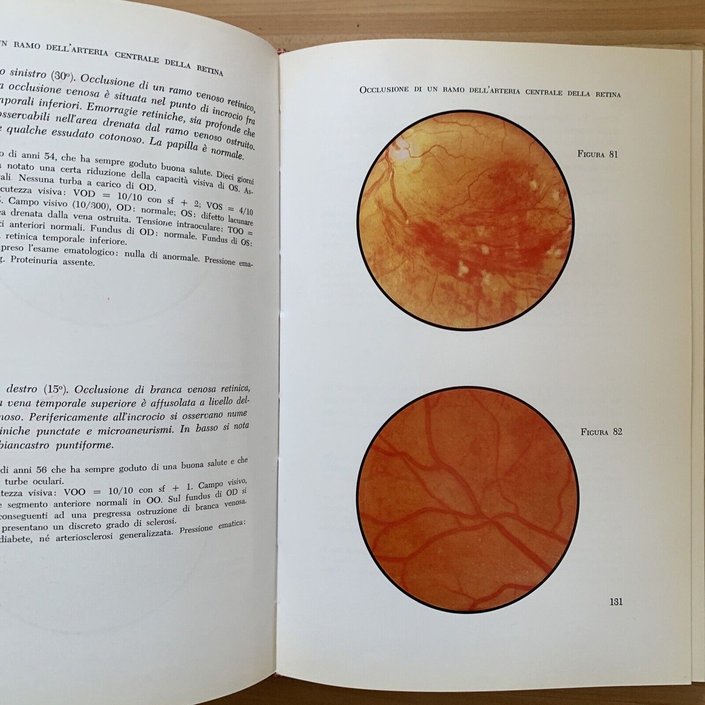 ATLANTE DEL FONDO DELL'OCCHIO - H. W. LARSEN. Luigi Russo editore 1964
