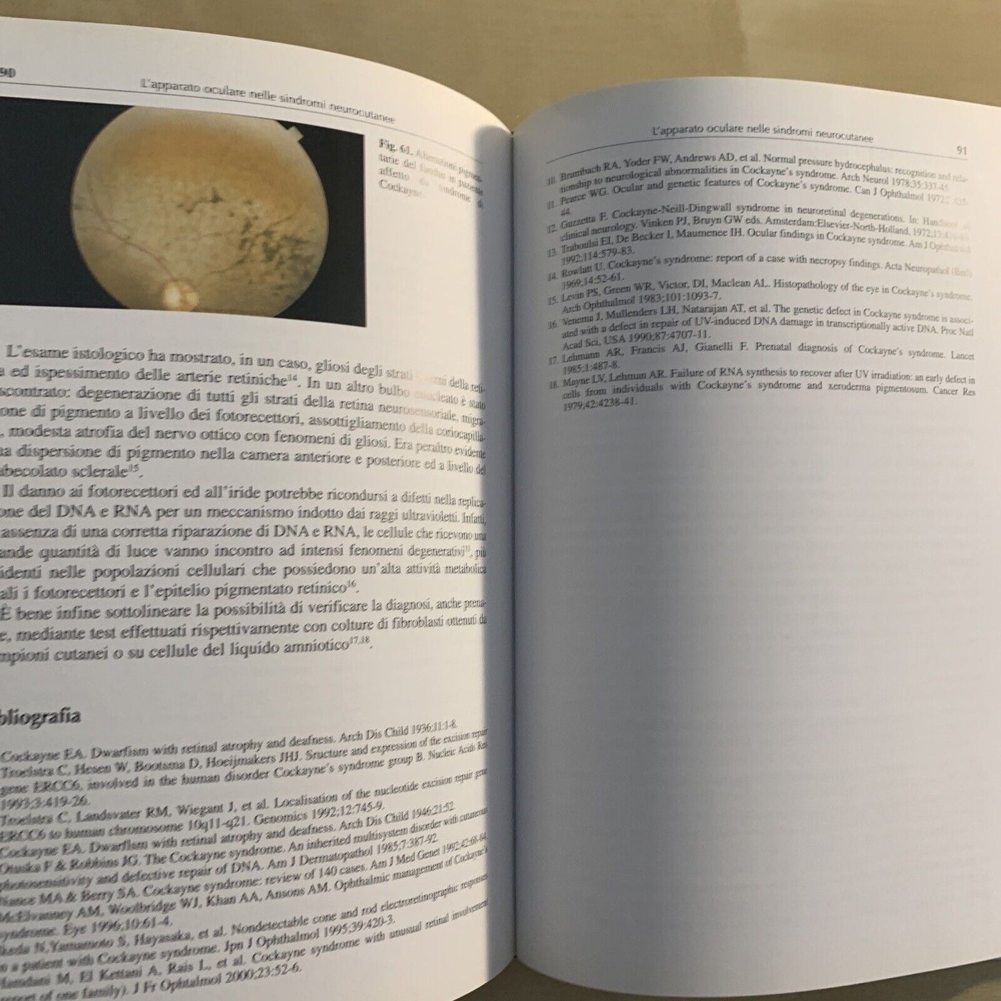 L'APPARATO OCULARE NELLE SINDROMI NEUROCUTANEE - Santi Maria recupero. Verduci #