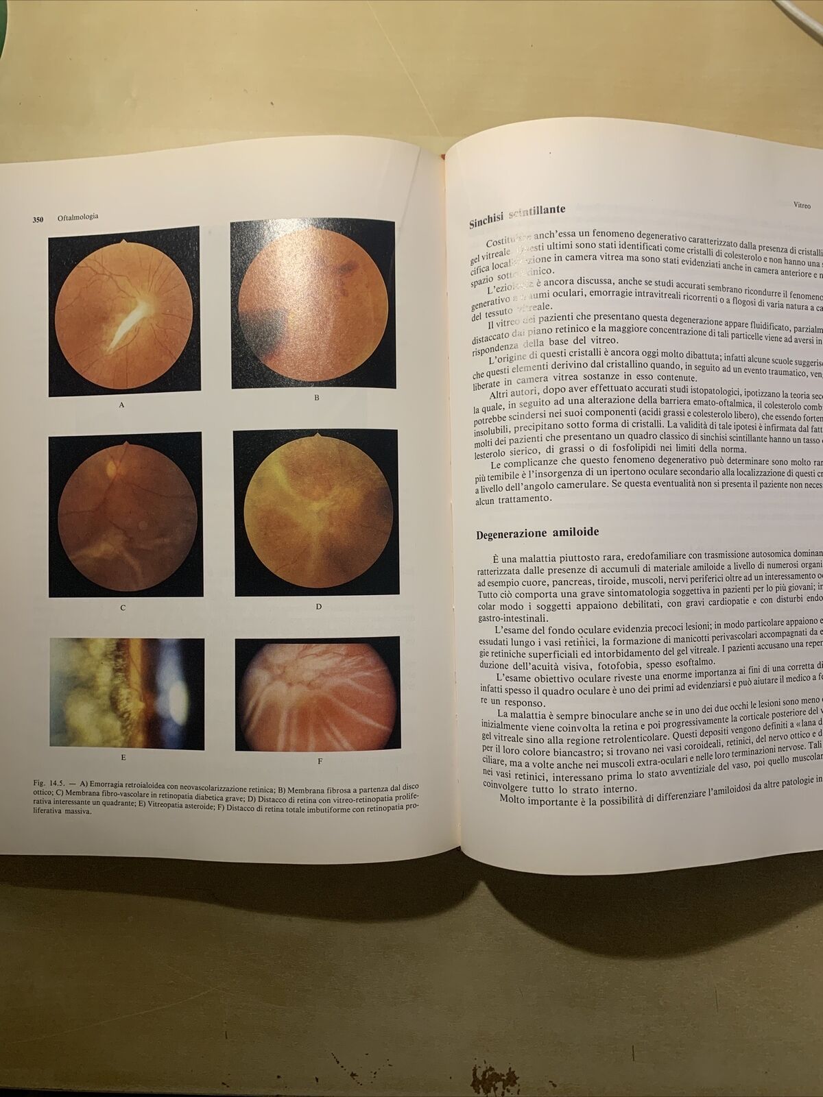 OFTALMOLOGIA - MASSIMO G. BUCCI. EDITRICE UNIVERSO 1993