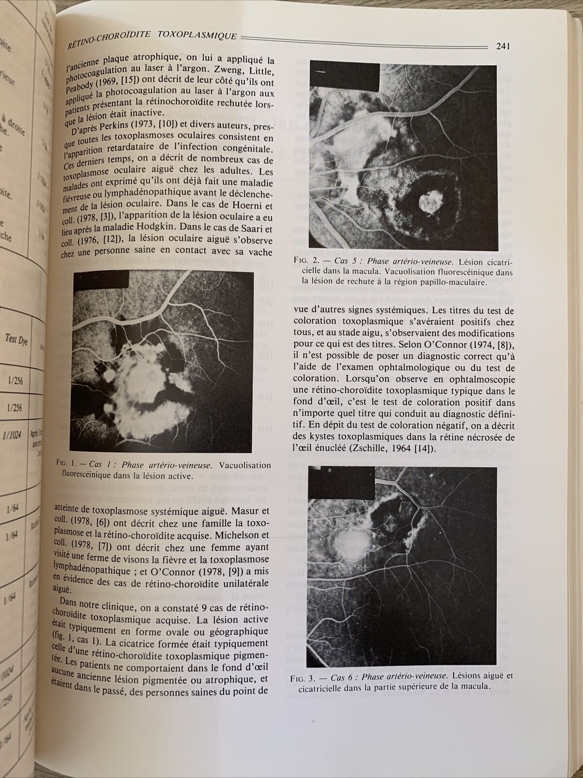 Bulletins et mémoires de la Société francaise d'Ophtalmologie - Masson 1982 #