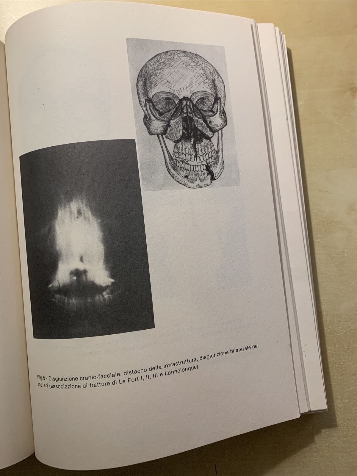 Omaggio a Paride Stefanini - Istituto Universitario di Medicina e Chirurgia 1982