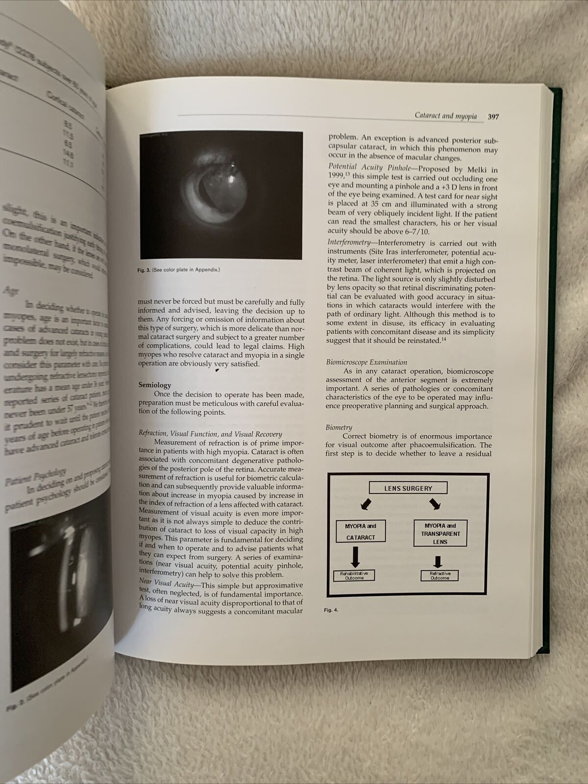 MYOPIA AND RELATED DISEASES. EDOARDO MIDENA. G. B. BIETTI 2005 OFTALMOLOGIA