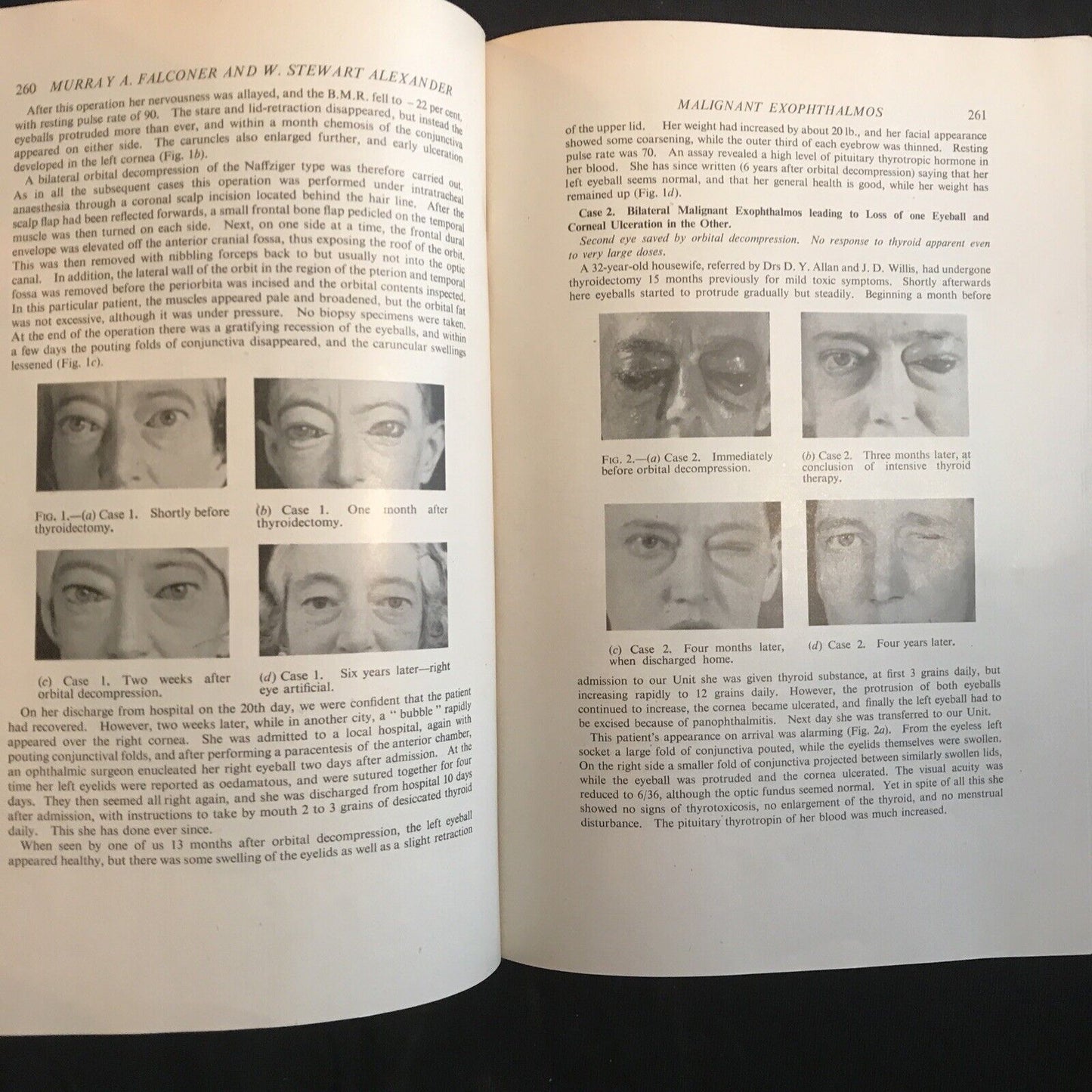 BRITISH JOURNAL OF OPHTHALMOLOGY, oftalmologia. Stewart Duke-Elder 1951 vol XXXV